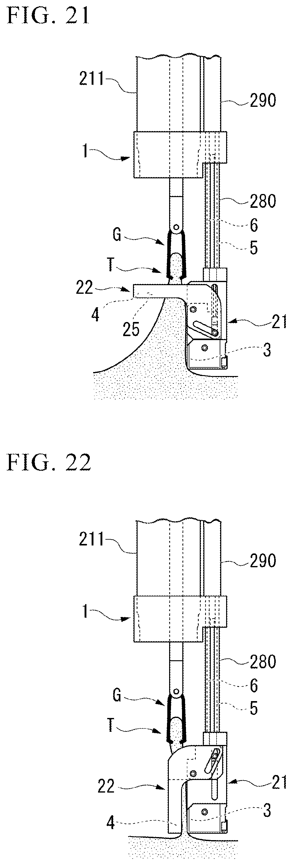 Patent US12426878 Figure 14 – Medical stapler and suturing method