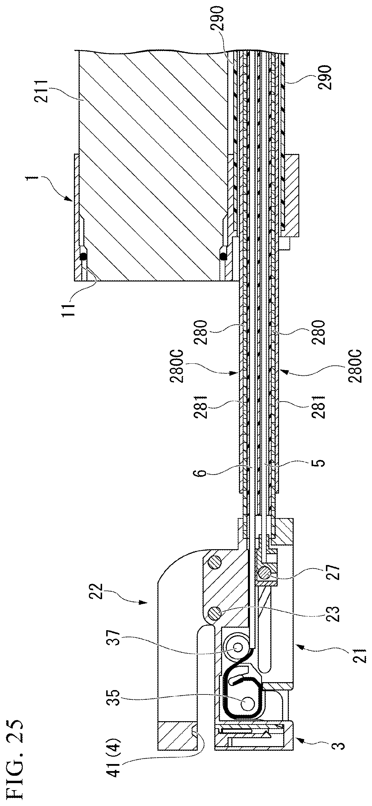 Patent US12426878 Figure 16 – Medical stapler and suturing method
