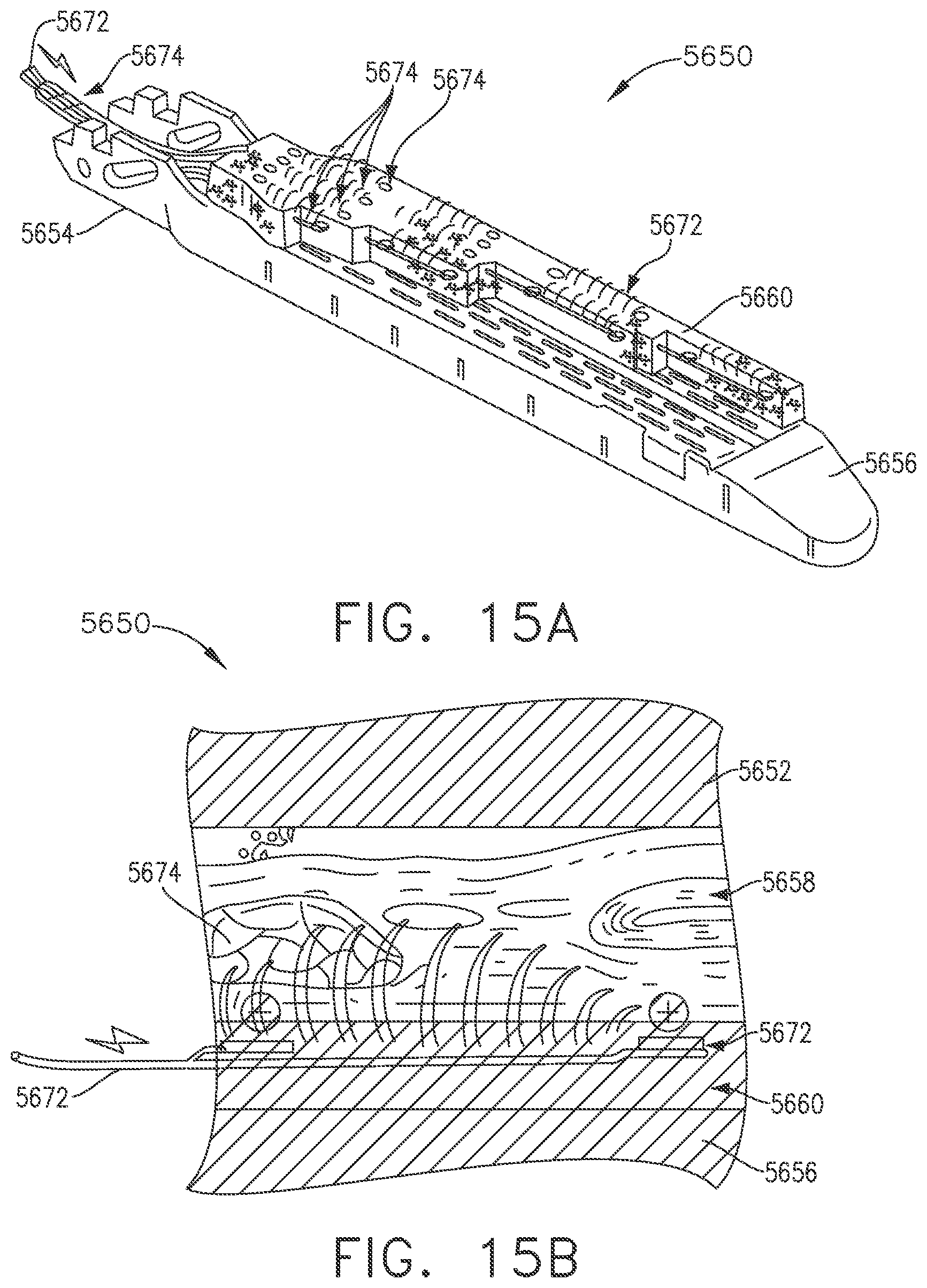 Patent US12426879 Figure 15 – Surgical system comprising control circuit to set velocity of closure driver based on sensor data