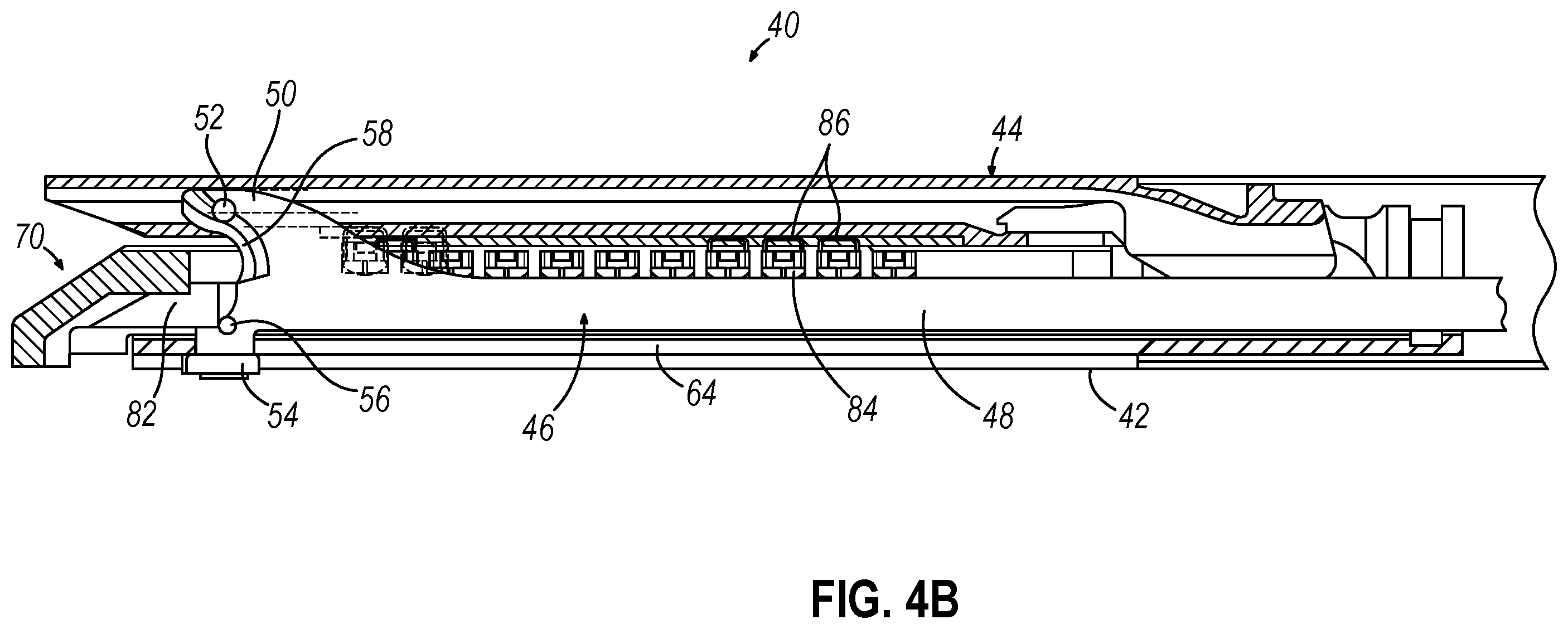 Patent US12426880 Figure 5 – Surgical stapler cartridge having intermediate raised tissue engagement protrusions