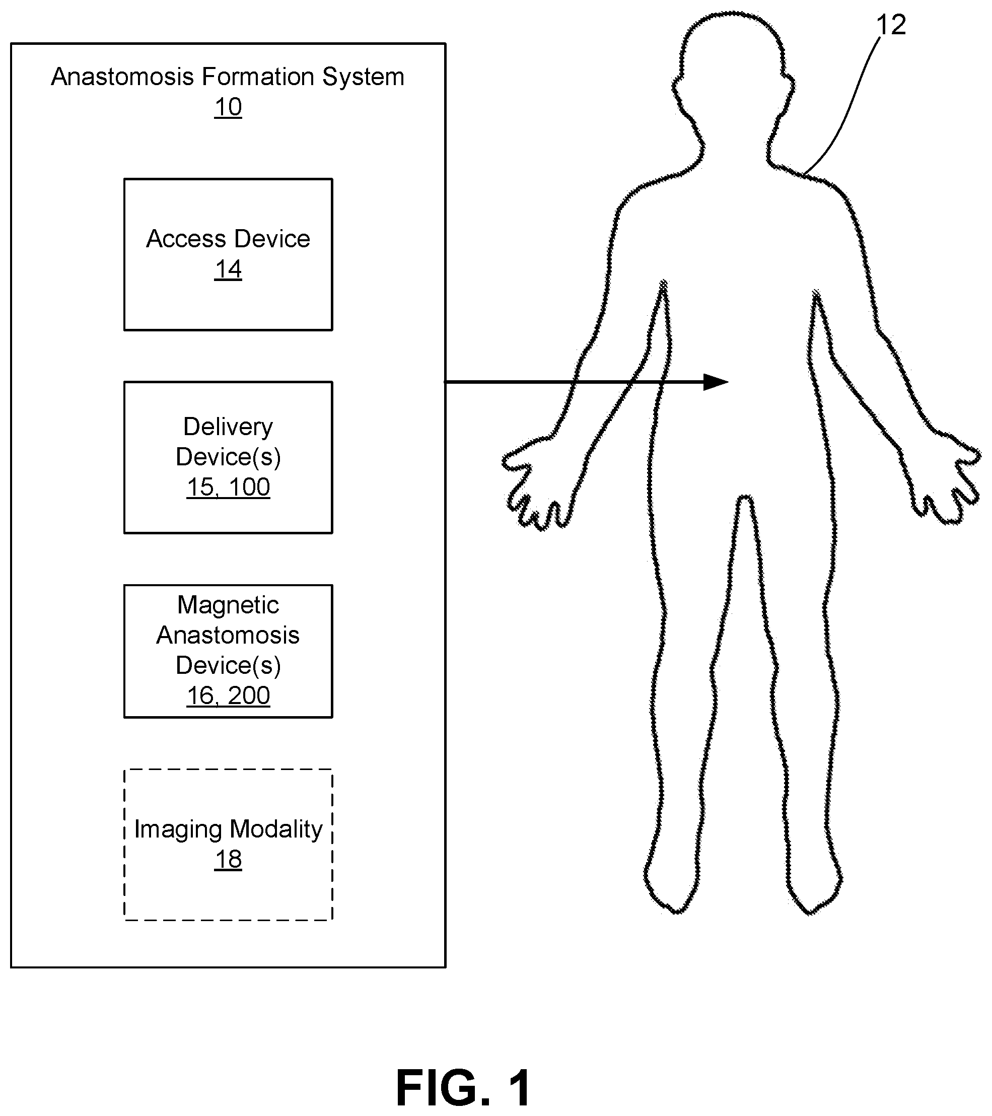 Patent US12426884 Figure 1 – Systems, devices, and methods for forming anastomoses