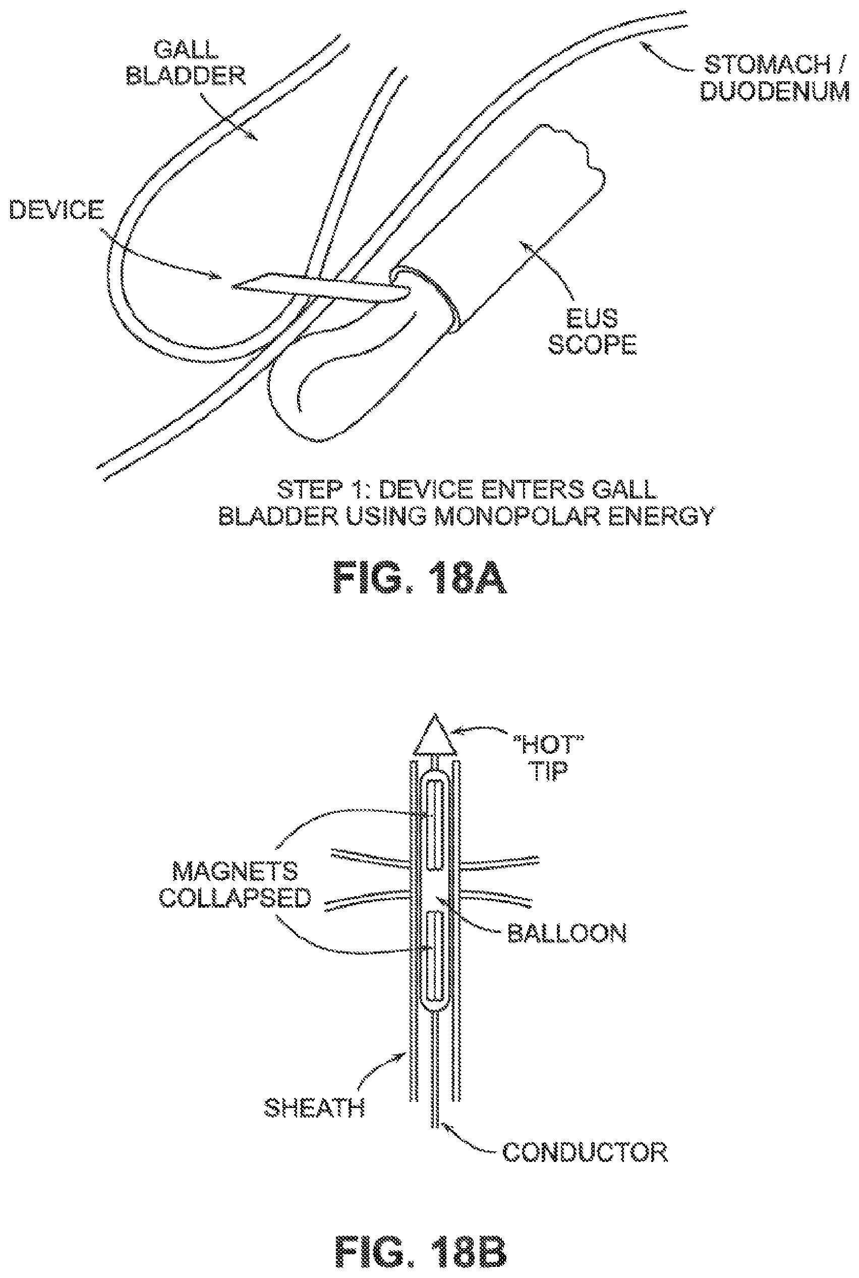 Patent US12426884 Figure 14 – Systems, devices, and methods for forming anastomoses