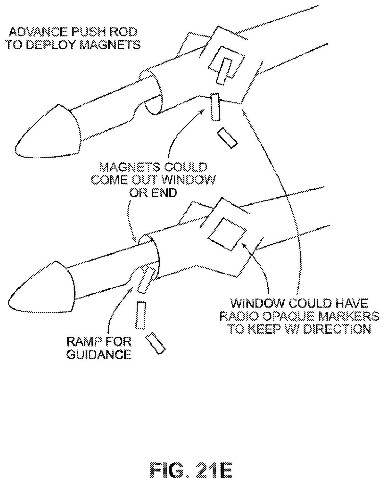 Patent US12426884 Figure 20 – Systems, devices, and methods for forming anastomoses