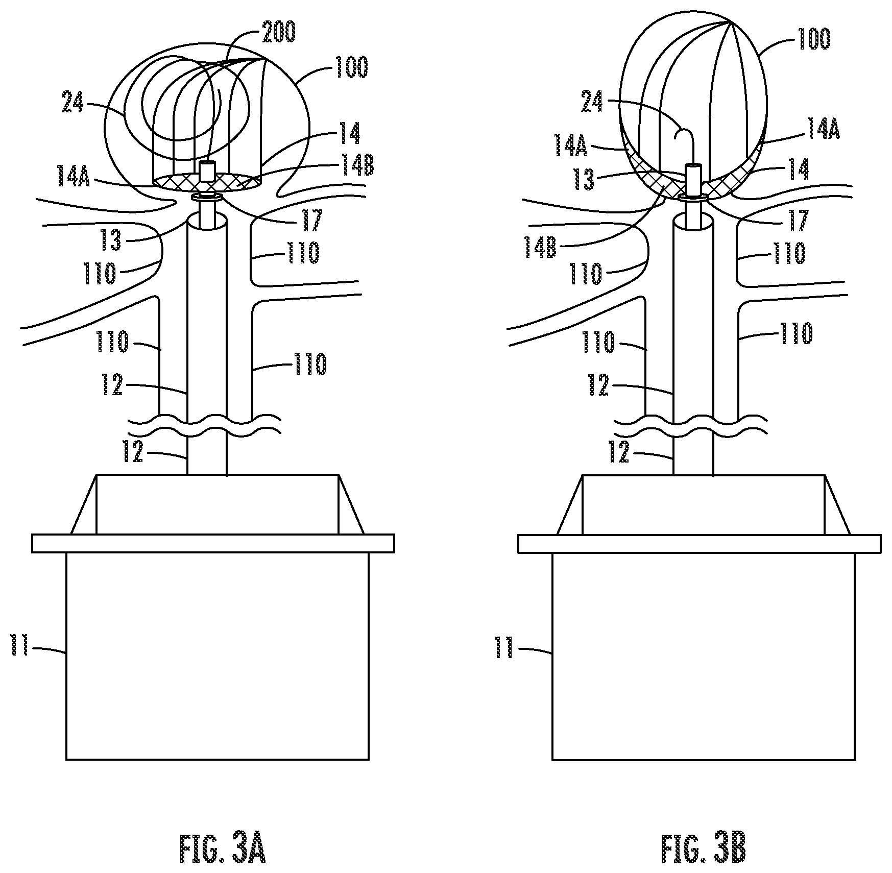 Patent US12426885 Figure 3 – Mesh cap for ameliorating outpouchings