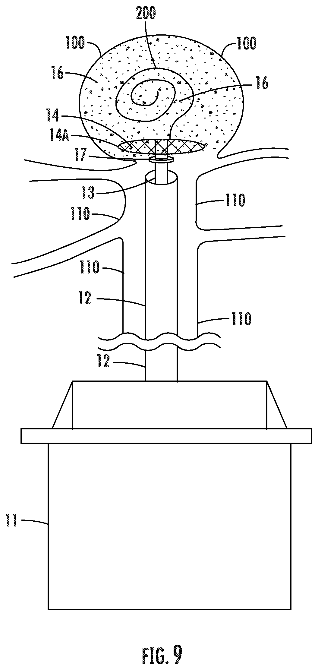 Patent US12426885 Figure 9 – Mesh cap for ameliorating outpouchings