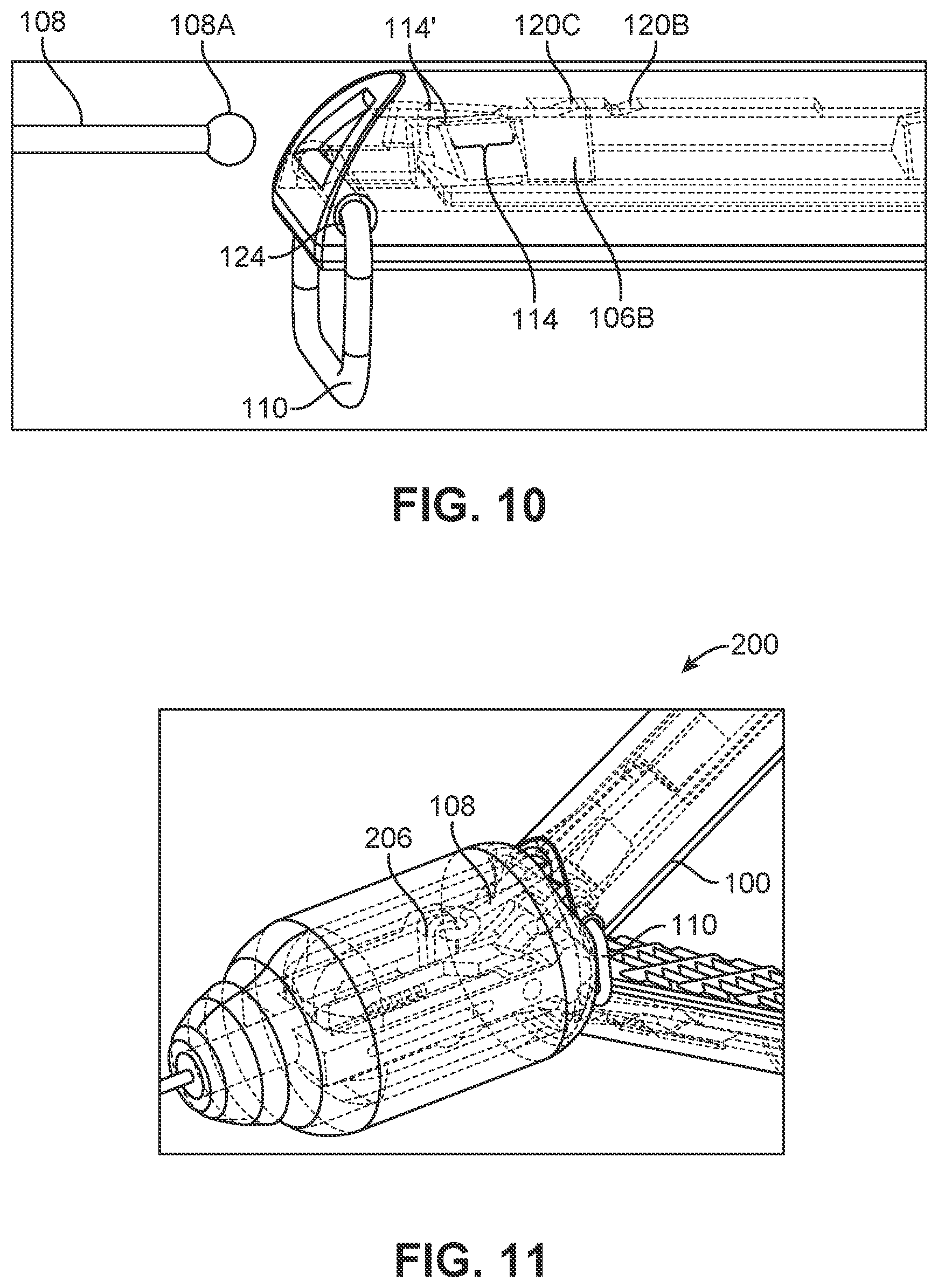 Patent US12426886 Figure 11 – Atrial appendage excluder