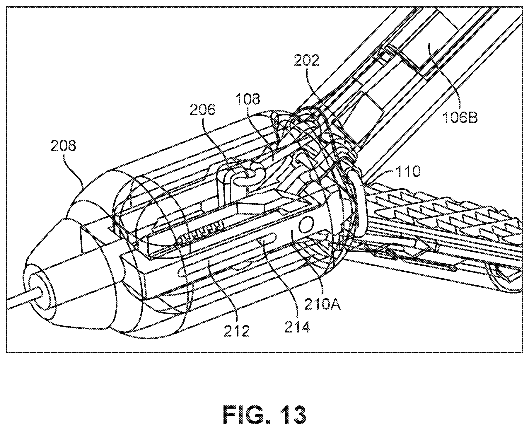 Patent US12426886 Figure 13 – Atrial appendage excluder