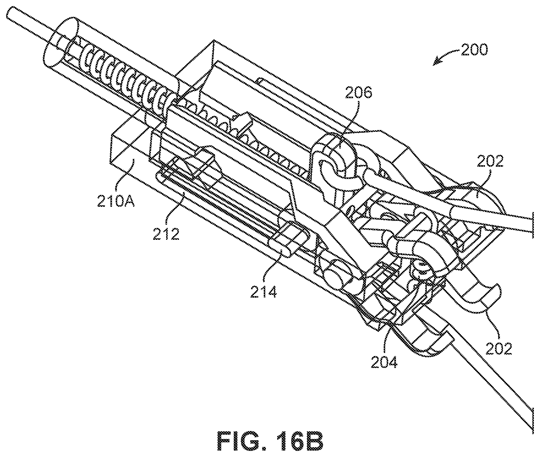 Patent US12426886 Figure 17 – Atrial appendage excluder