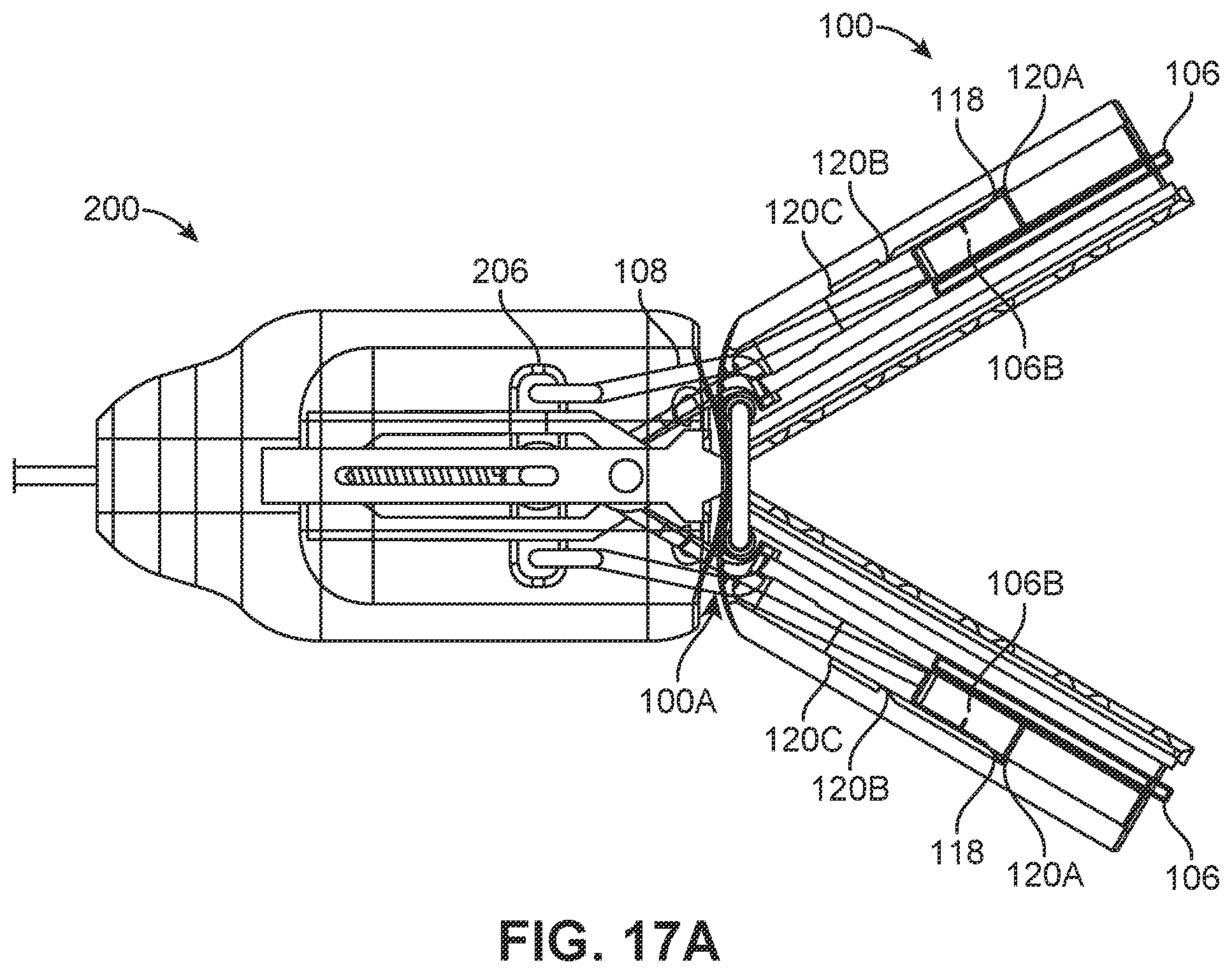 Patent US12426886 Figure 18 – Atrial appendage excluder