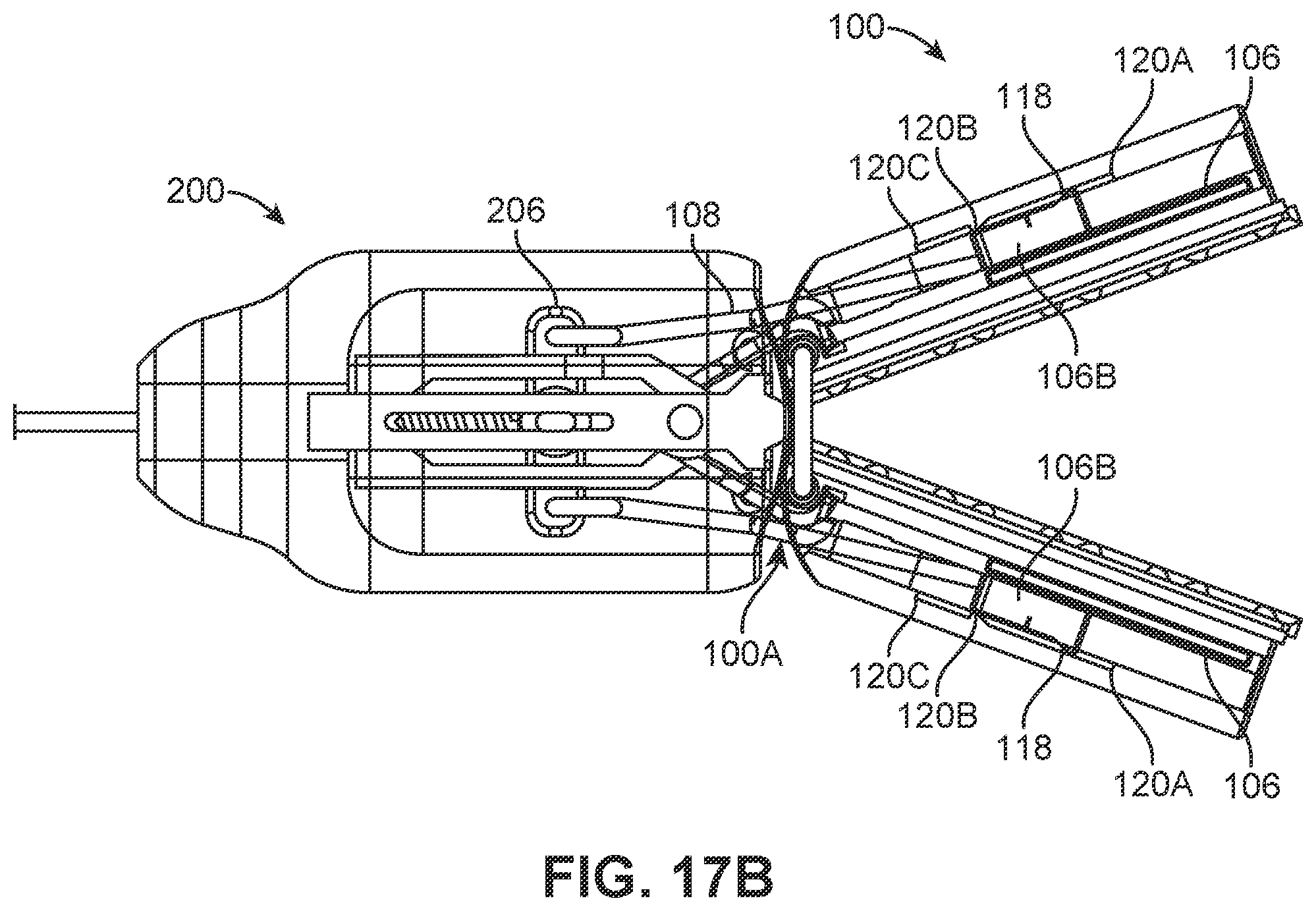 Patent US12426886 Figure 19 – Atrial appendage excluder