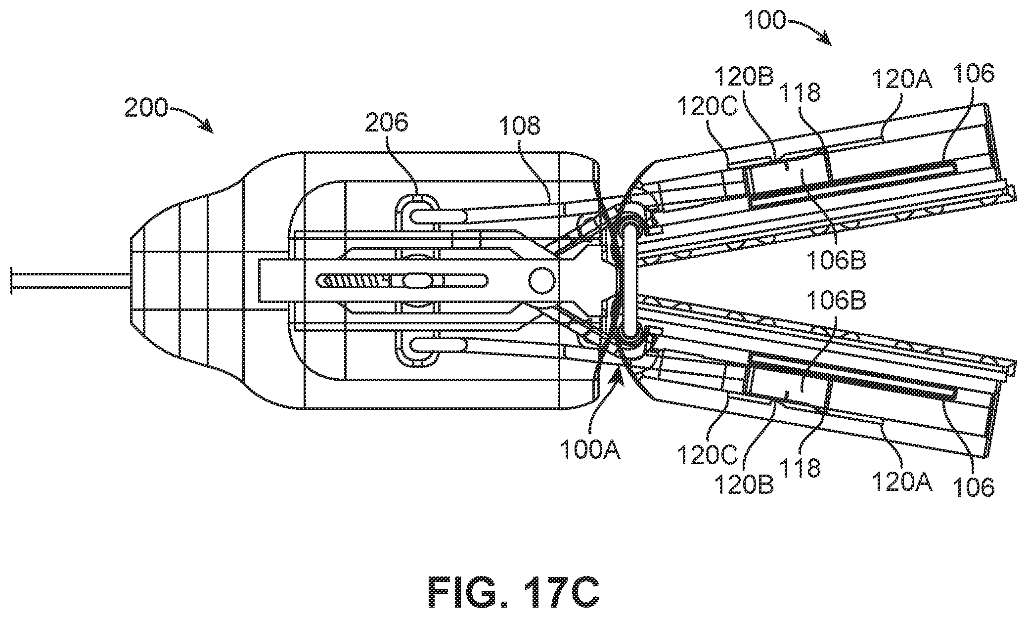 Patent US12426886 Figure 20 – Atrial appendage excluder