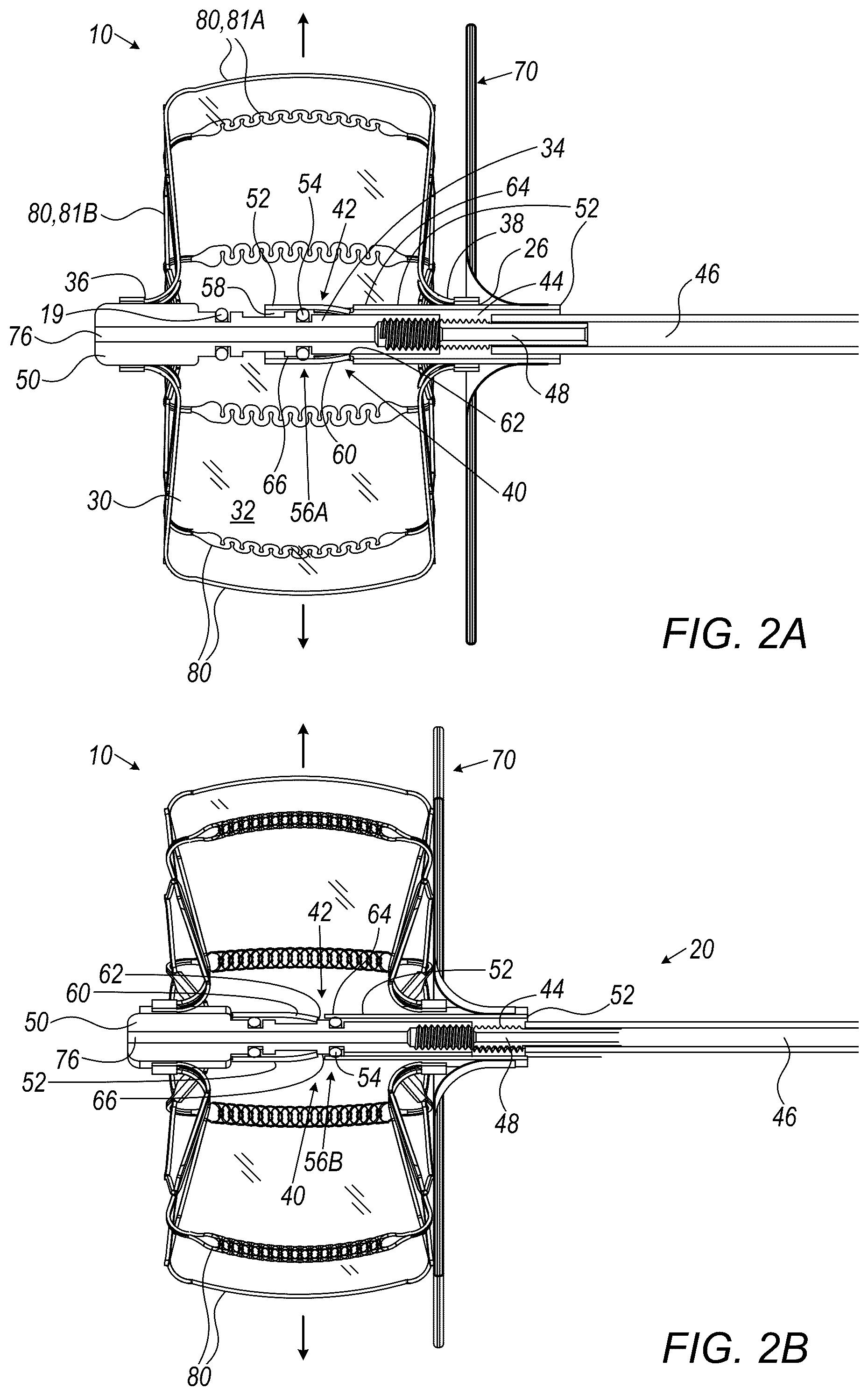 Patent US12426887 Figure 2 – Left atrial appendage occlusion devices