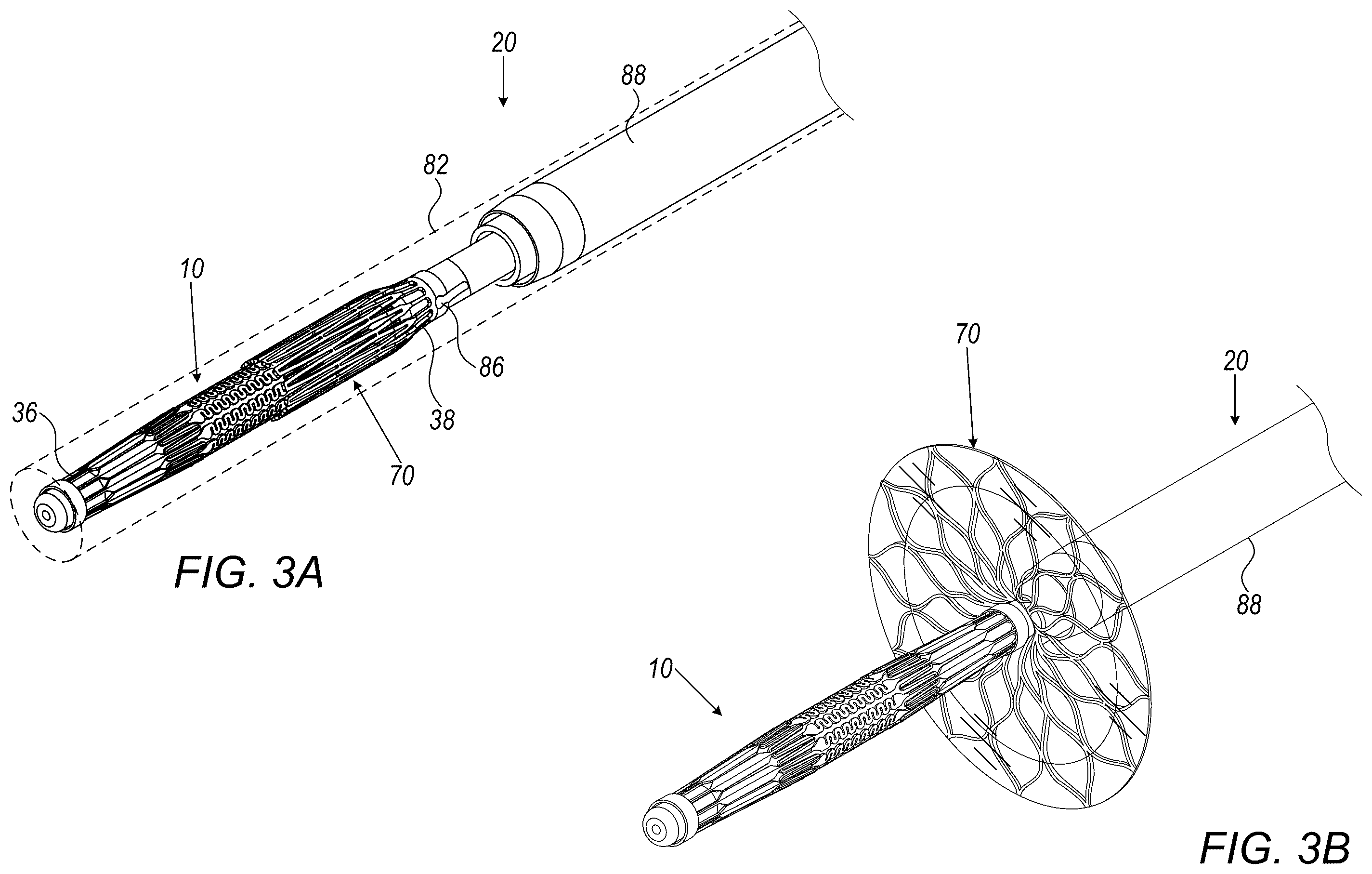 Patent US12426887 Figure 3 – Left atrial appendage occlusion devices