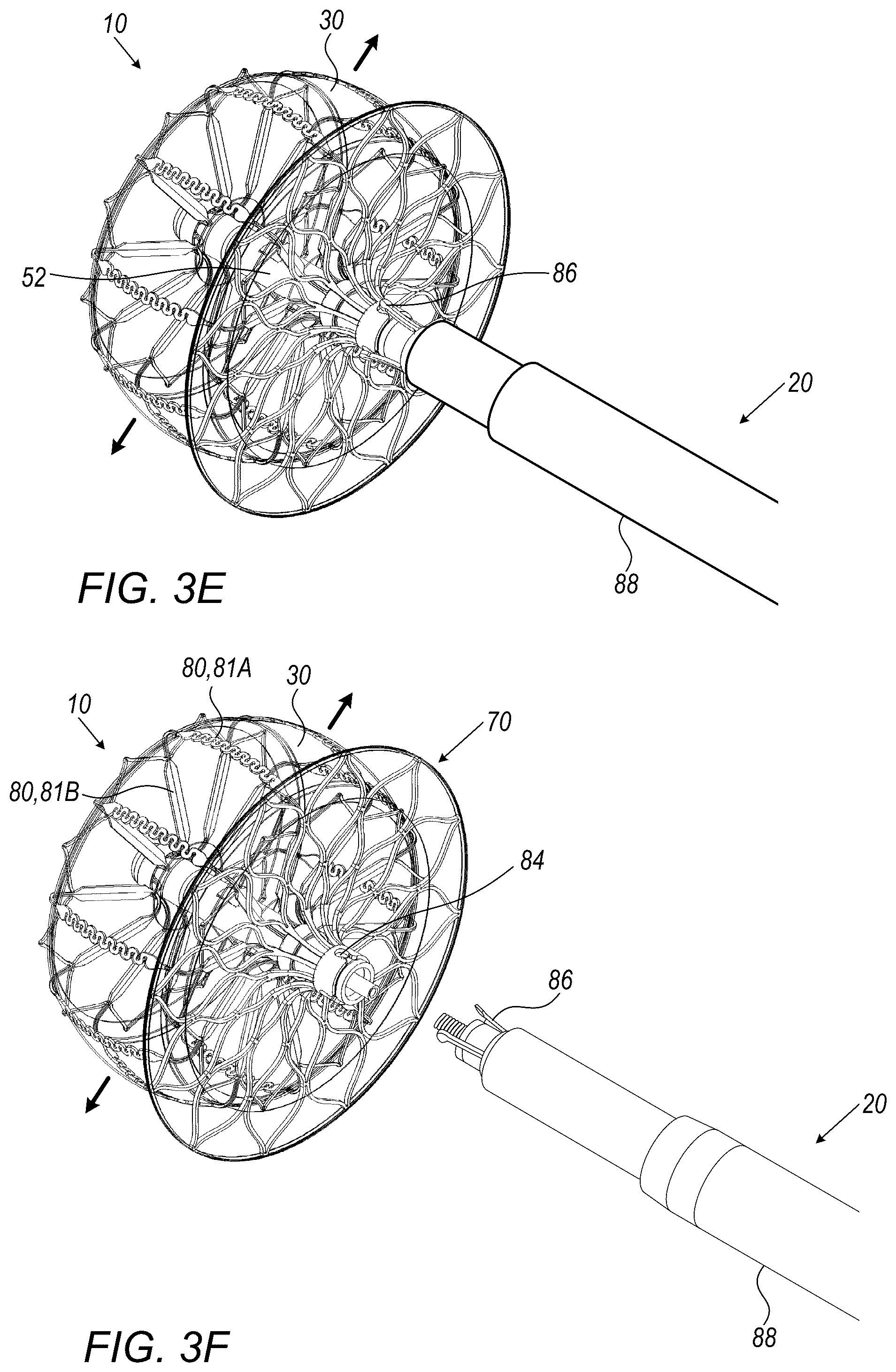 Patent US12426887 Figure 5 – Left atrial appendage occlusion devices
