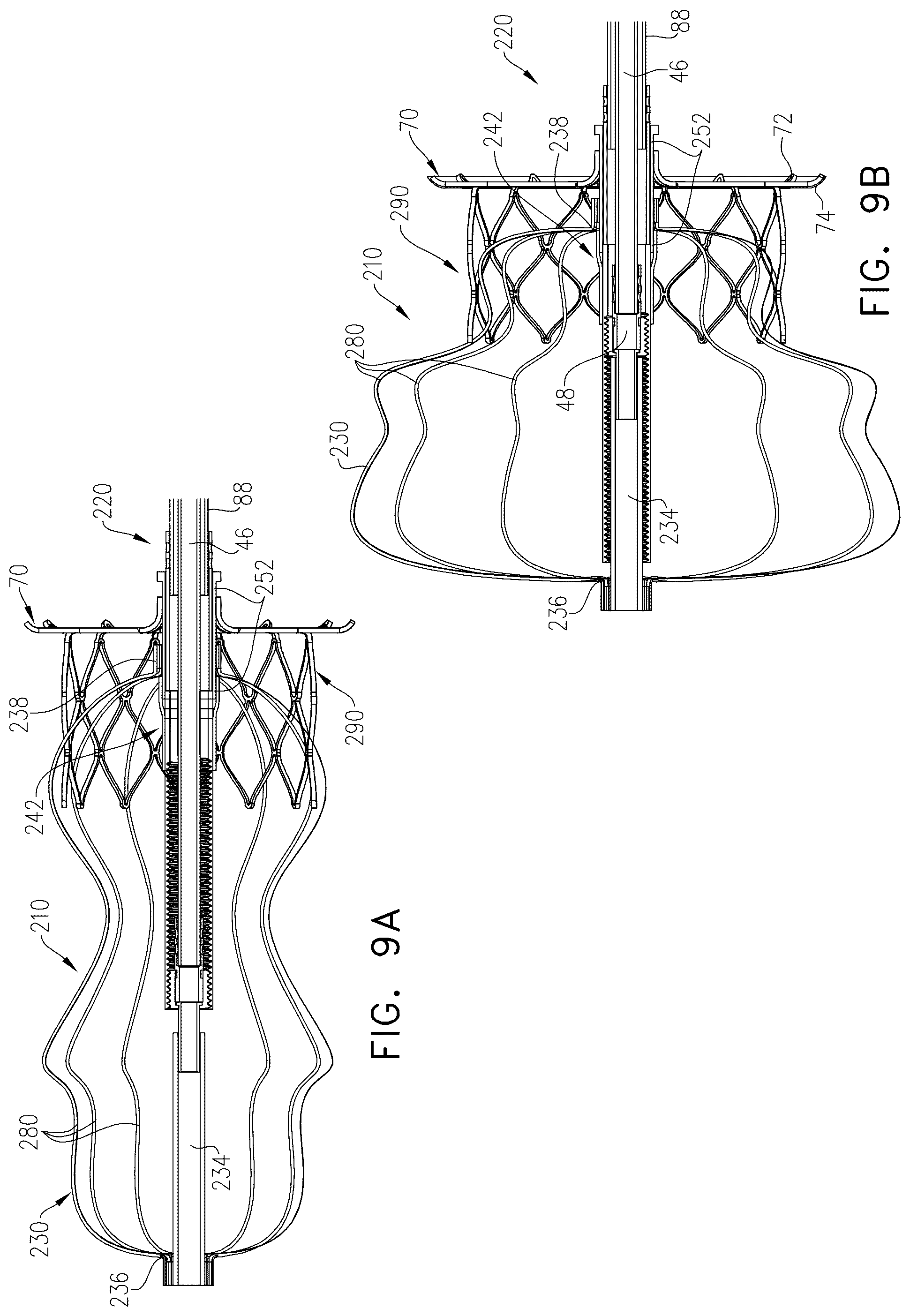 Patent US12426887 Figure 14 – Left atrial appendage occlusion devices