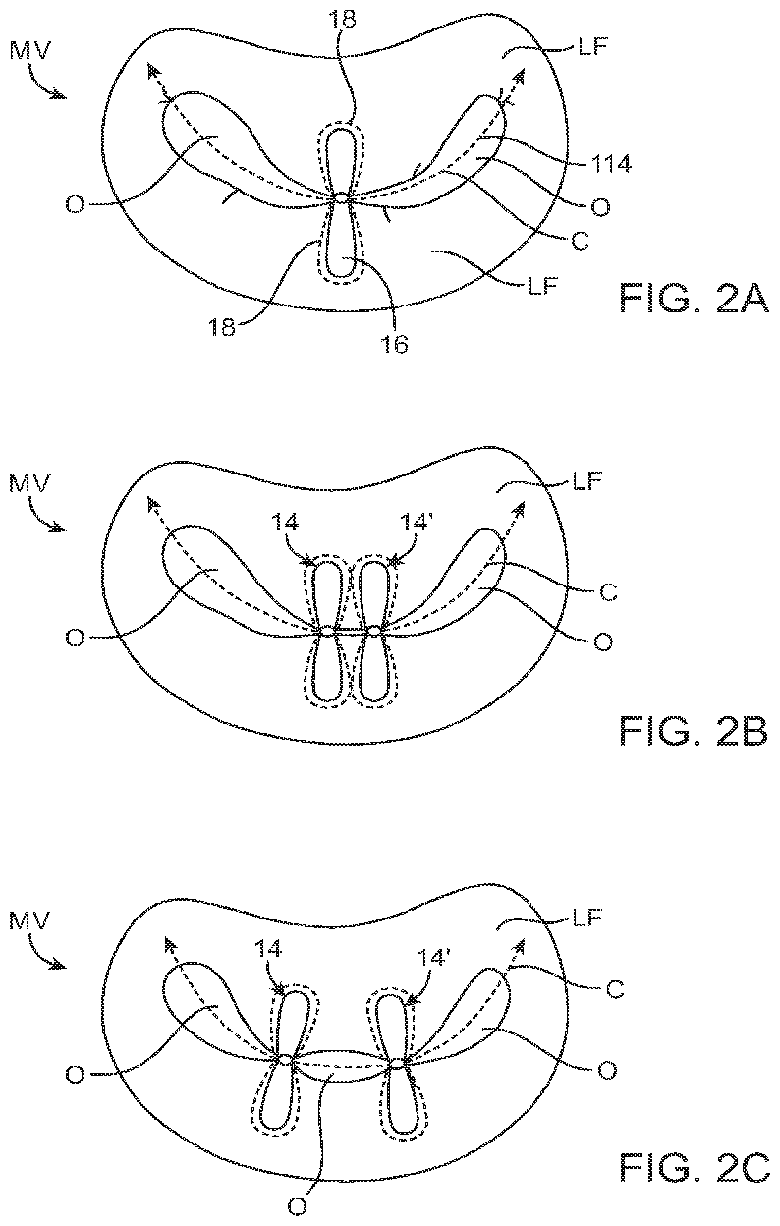 Patent US12426890 Figure 2 – Systems for tissue grasping and assessment