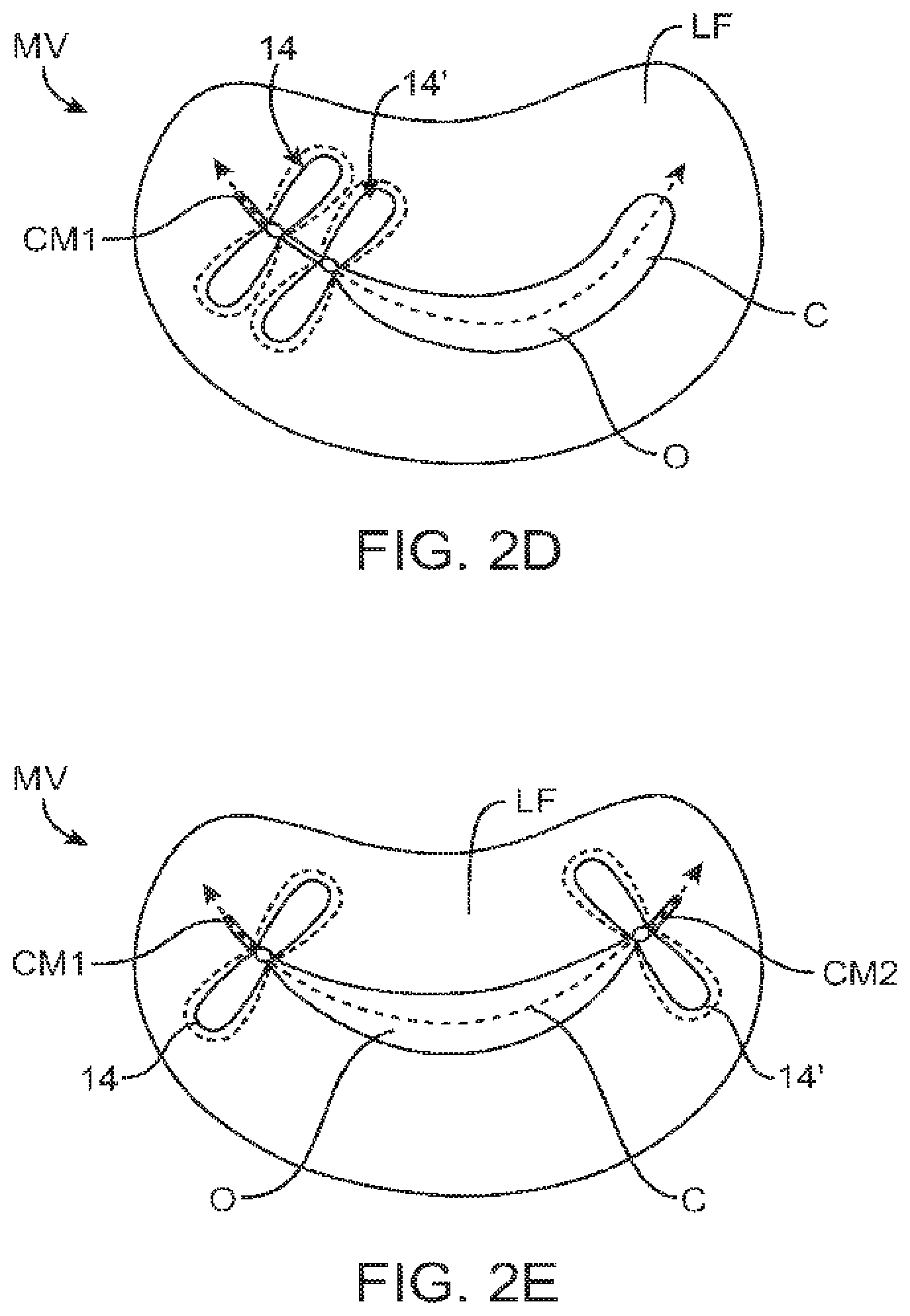 Patent US12426890 Figure 3 – Systems for tissue grasping and assessment