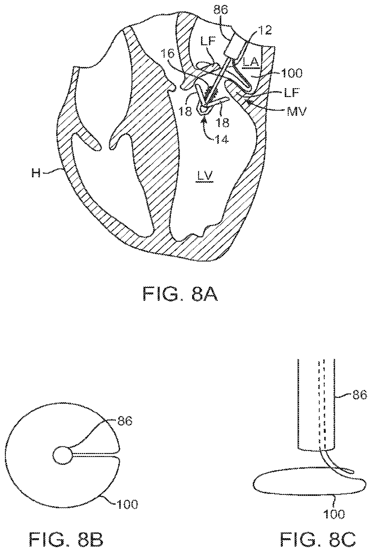 Patent US12426890 Figure 7 – Systems for tissue grasping and assessment