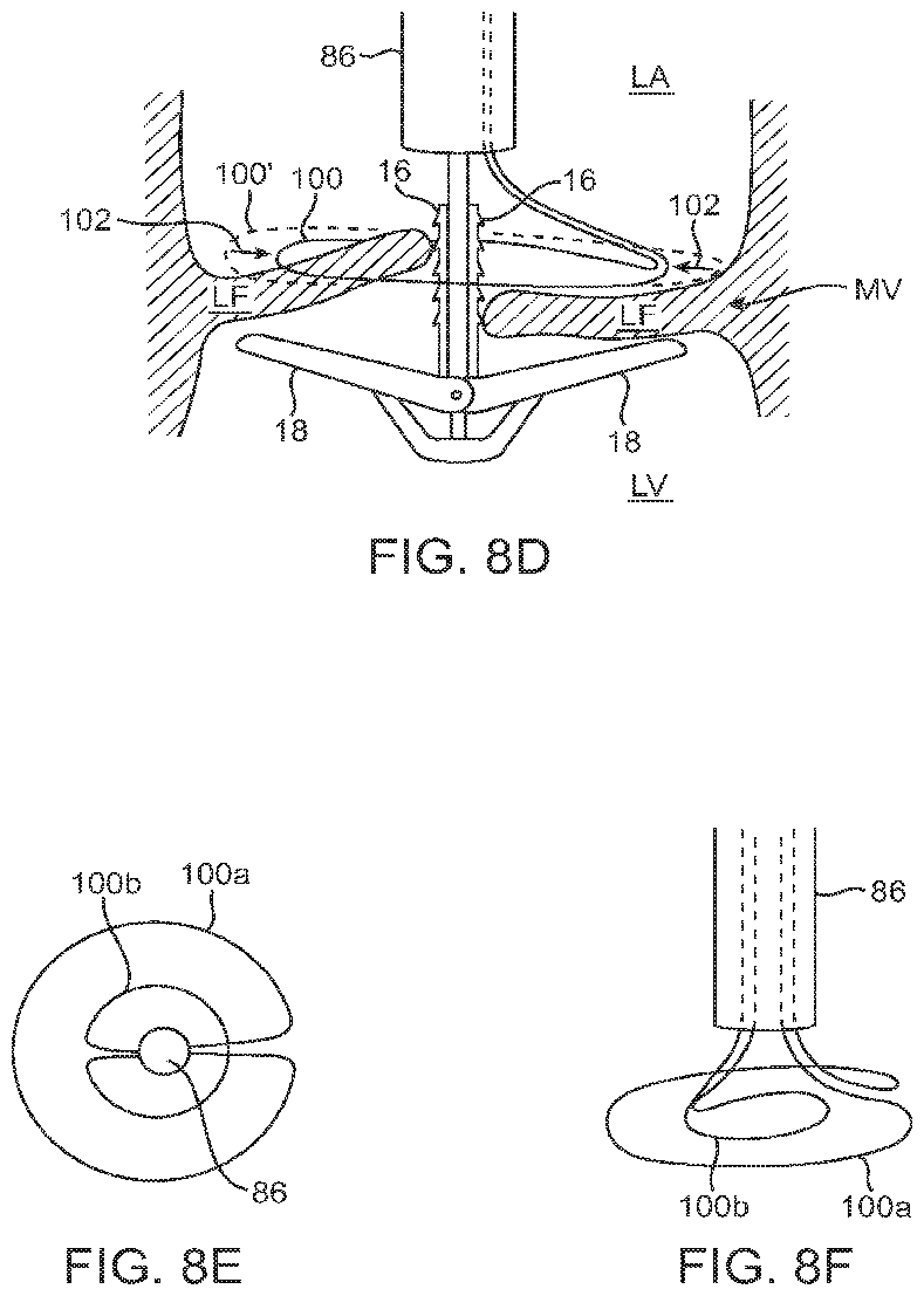 Patent US12426890 Figure 8 – Systems for tissue grasping and assessment