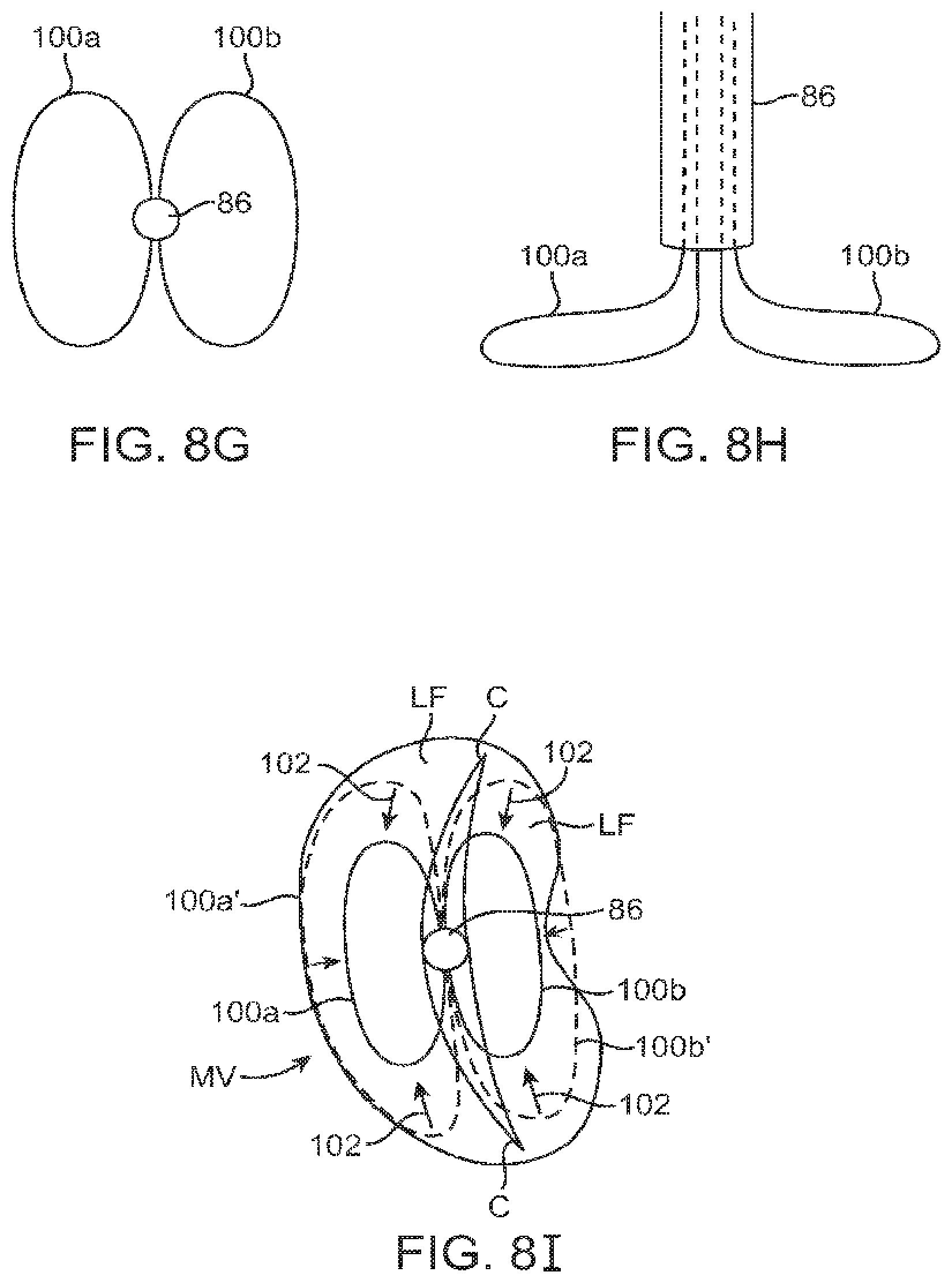 Patent US12426890 Figure 9 – Systems for tissue grasping and assessment