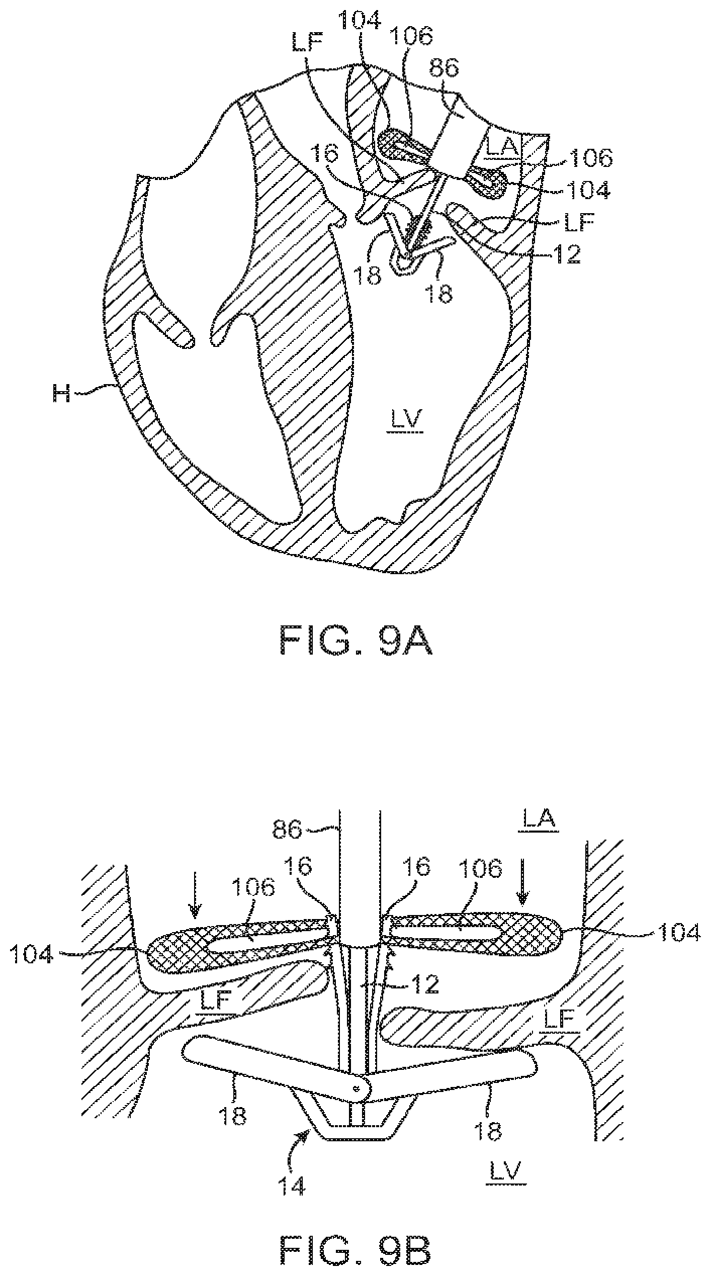 Patent US12426890 Figure 11 – Systems for tissue grasping and assessment