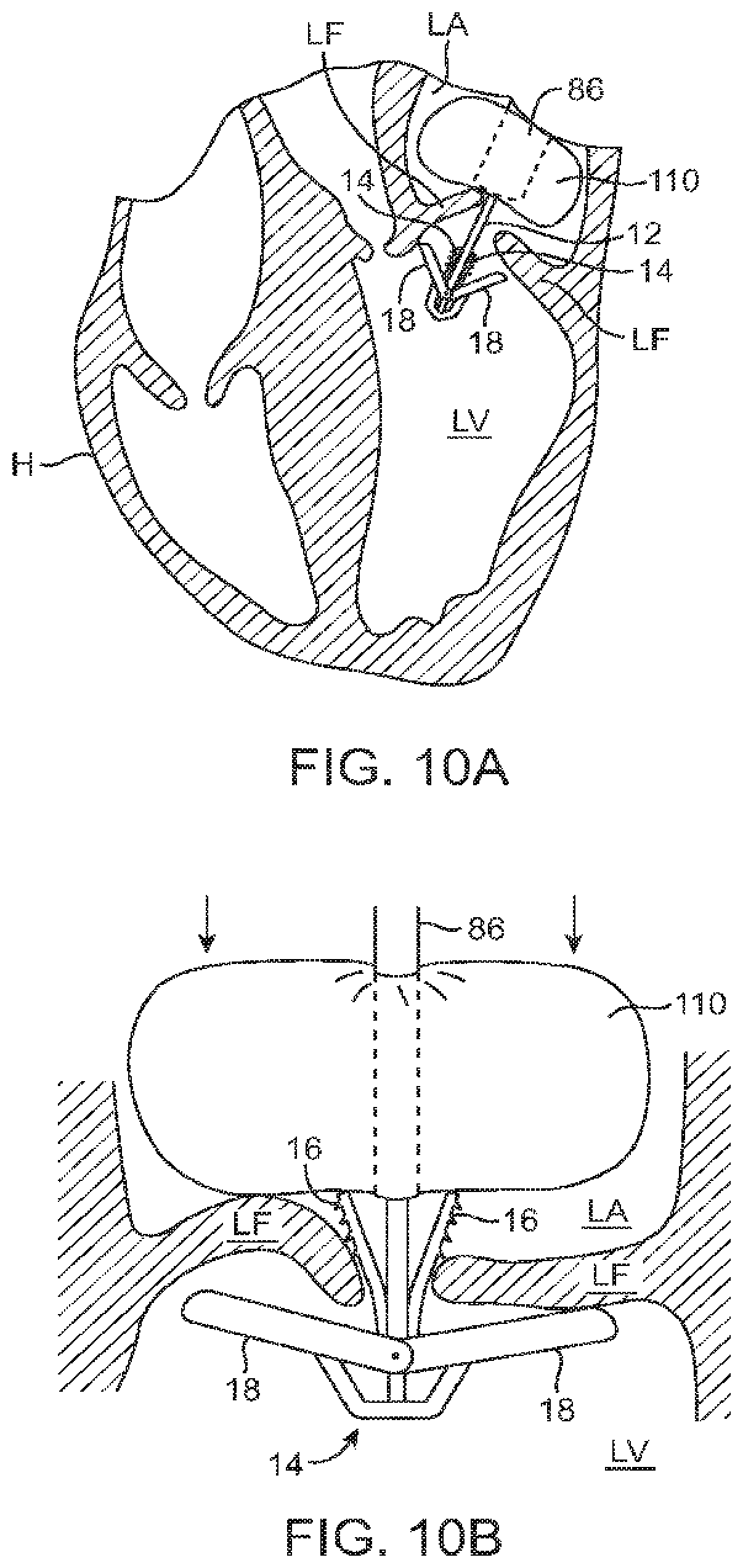 Patent US12426890 Figure 12 – Systems for tissue grasping and assessment
