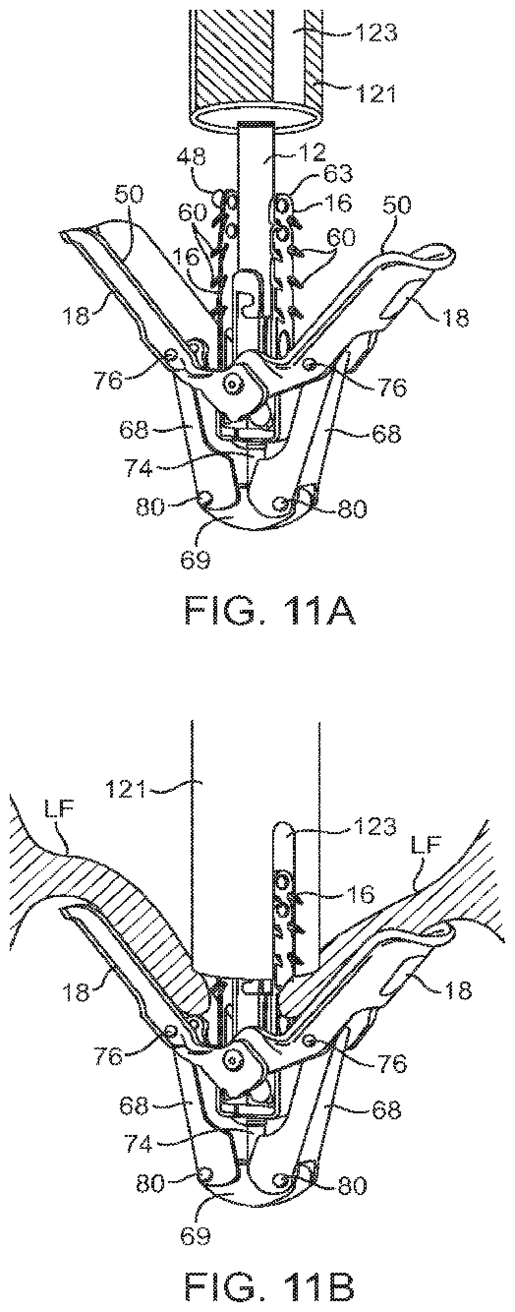 Patent US12426890 Figure 13 – Systems for tissue grasping and assessment