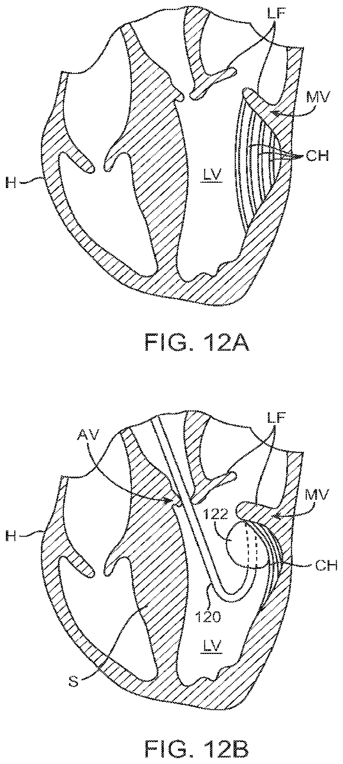 Patent US12426890 Figure 14 – Systems for tissue grasping and assessment