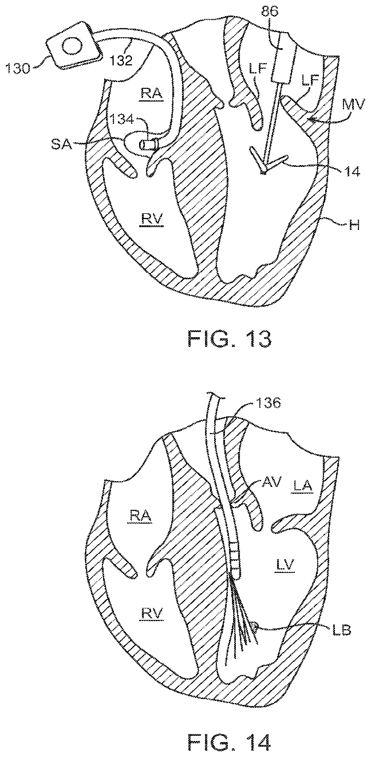 Patent US12426890 Figure 15 – Systems for tissue grasping and assessment