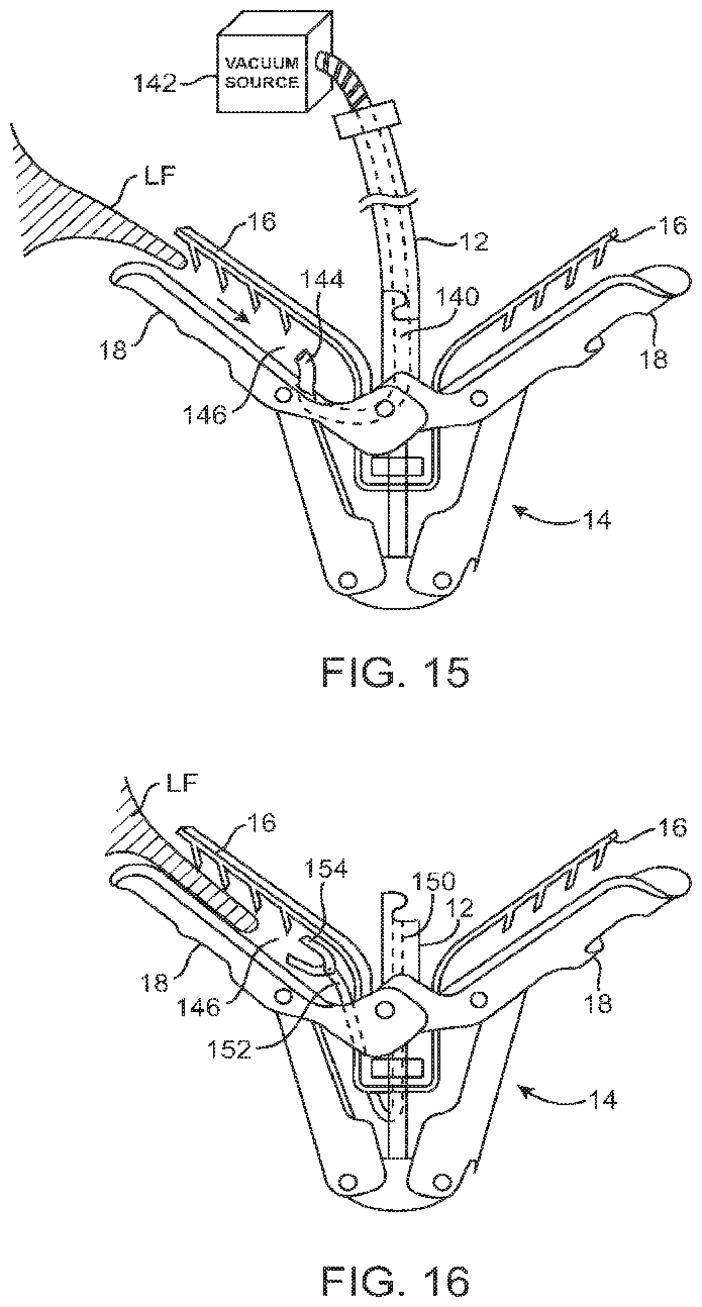 Patent US12426890 Figure 16 – Systems for tissue grasping and assessment