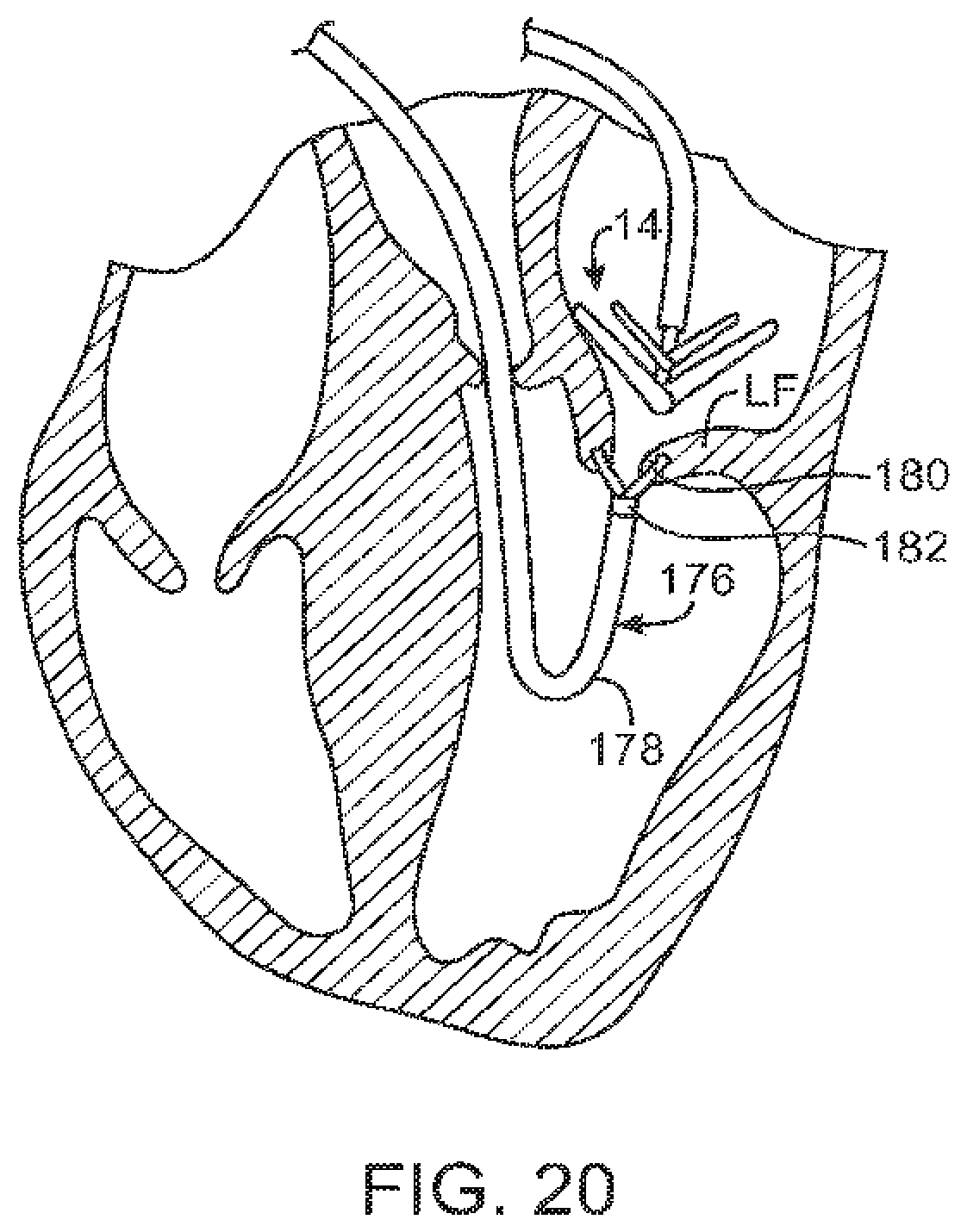 Patent US12426890 Figure 19 – Systems for tissue grasping and assessment