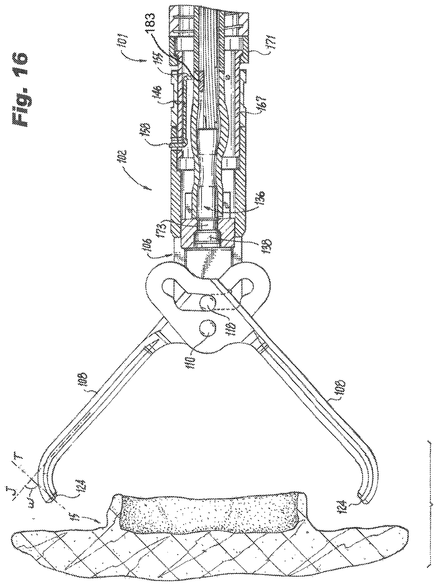 Patent US12426891 Figure 11 – Devices and methods for applying a hemostatic clip assembly