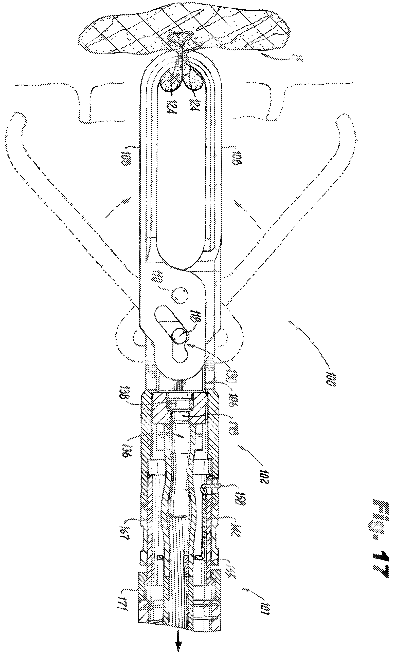 Patent US12426891 Figure 12 – Devices and methods for applying a hemostatic clip assembly