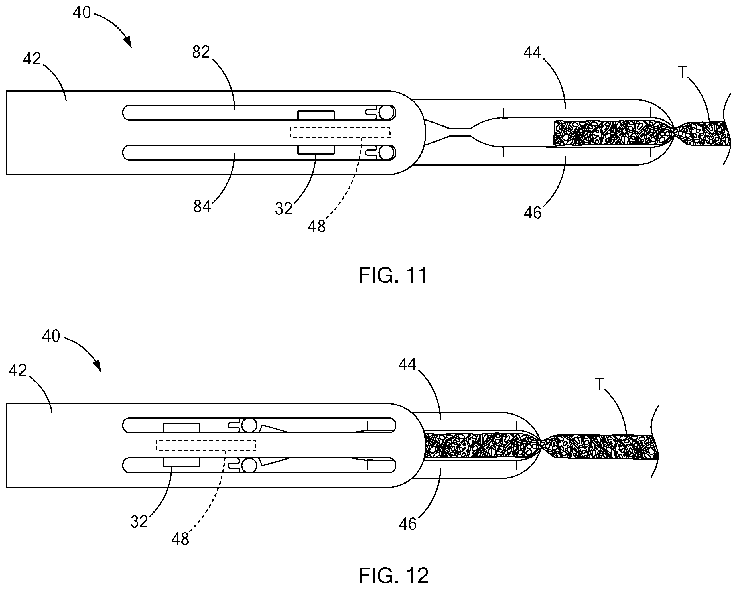 Patent US12426892 Figure 6 – Medical devices with detachable pivotable jaws