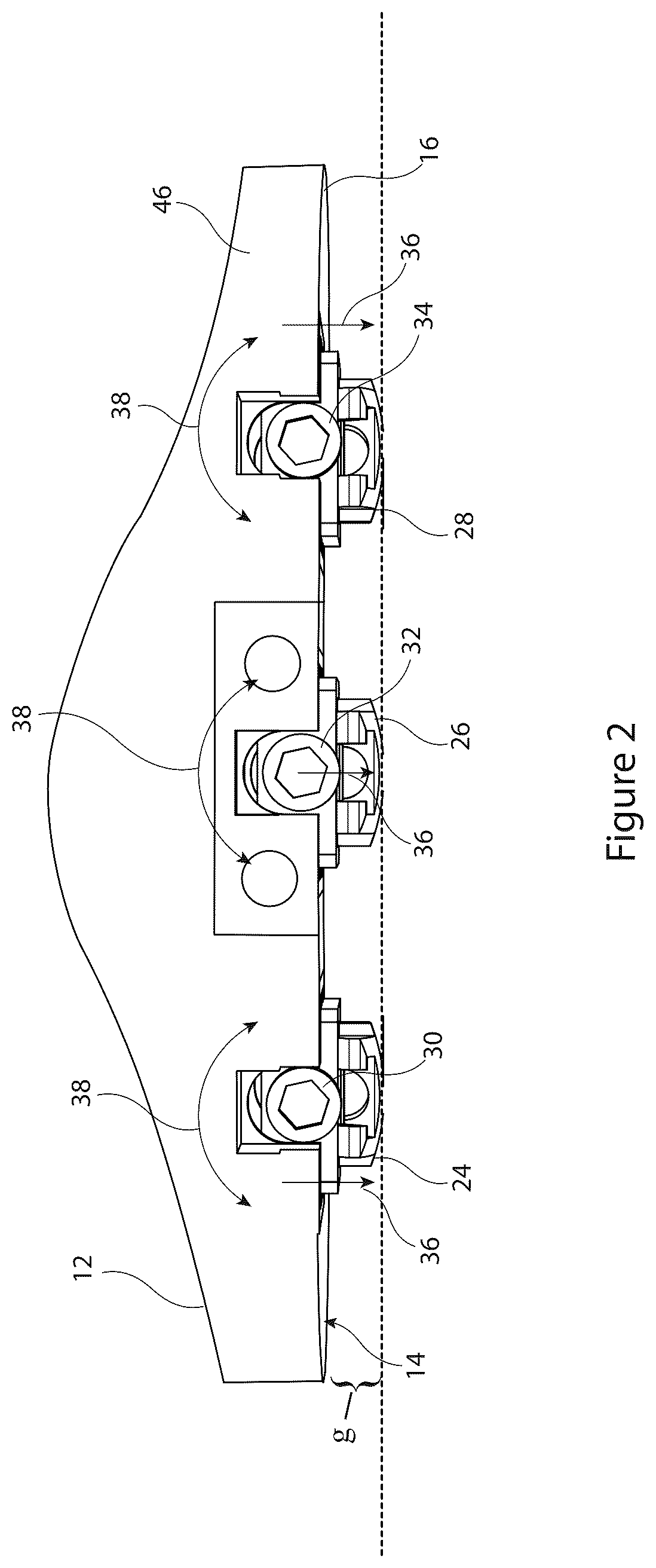 Patent US12426895 Figure 2 – Arrangement and method used in the preparation of bone surfaces of the knee joint for the components of a prosthetic knee joint
