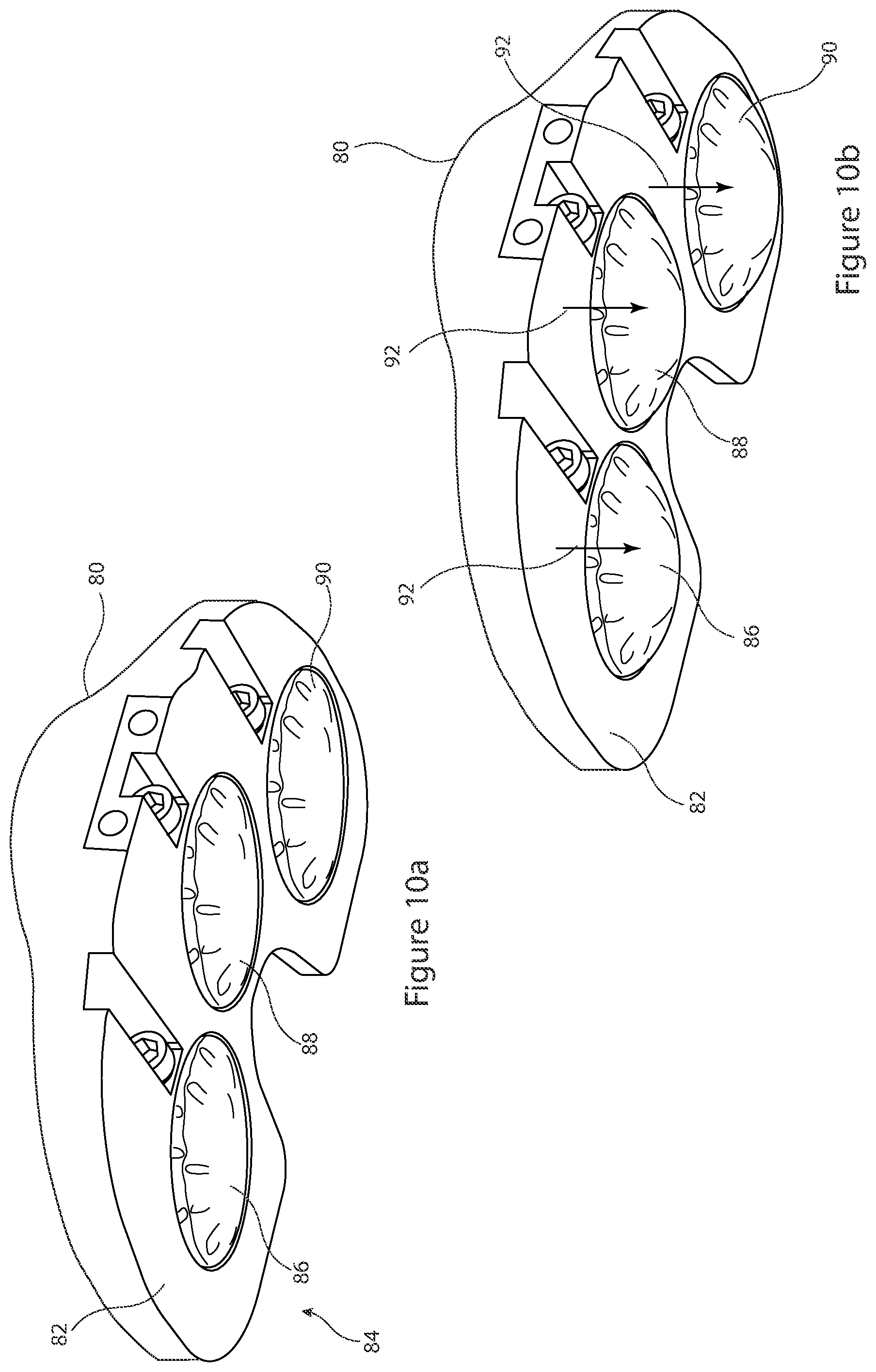 Patent US12426895 Figure 10 – Arrangement and method used in the preparation of bone surfaces of the knee joint for the components of a prosthetic knee joint