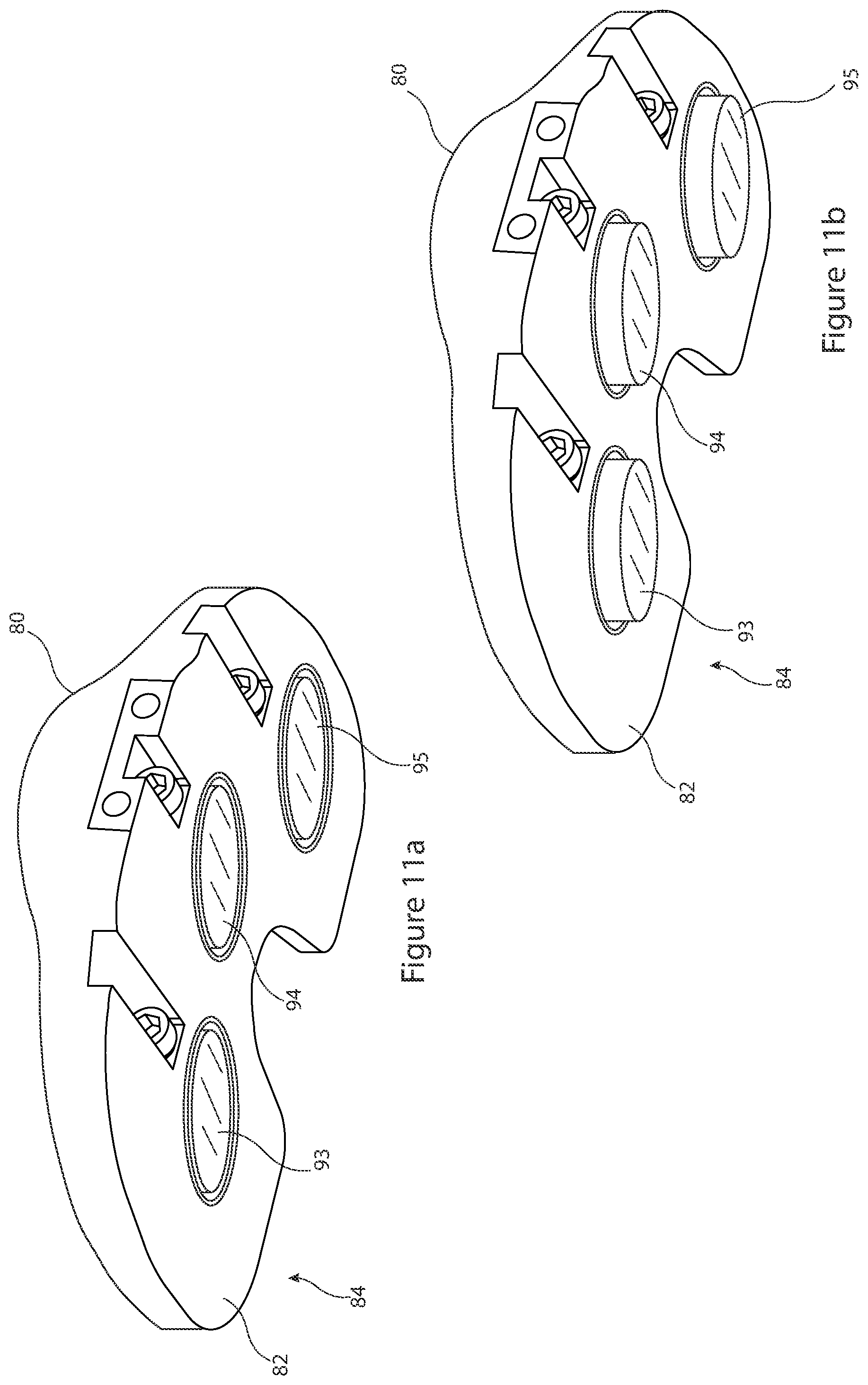 Patent US12426895 Figure 11 – Arrangement and method used in the preparation of bone surfaces of the knee joint for the components of a prosthetic knee joint