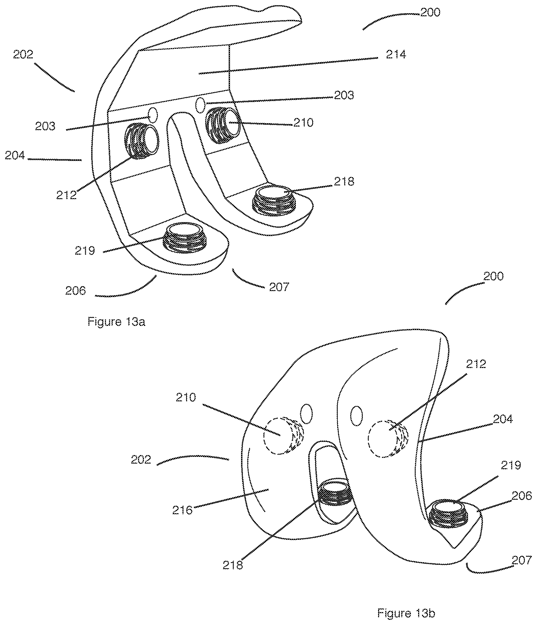 Patent US12426895 Figure 13 – Arrangement and method used in the preparation of bone surfaces of the knee joint for the components of a prosthetic knee joint
