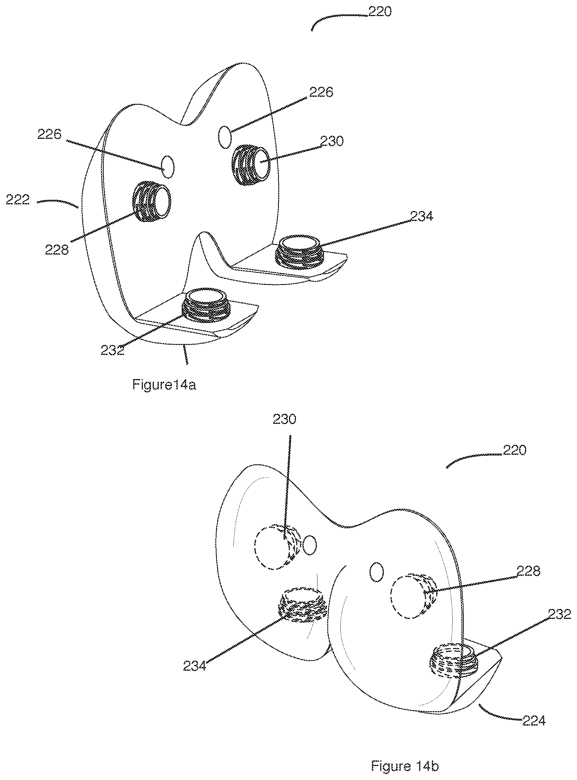 Patent US12426895 Figure 14 – Arrangement and method used in the preparation of bone surfaces of the knee joint for the components of a prosthetic knee joint