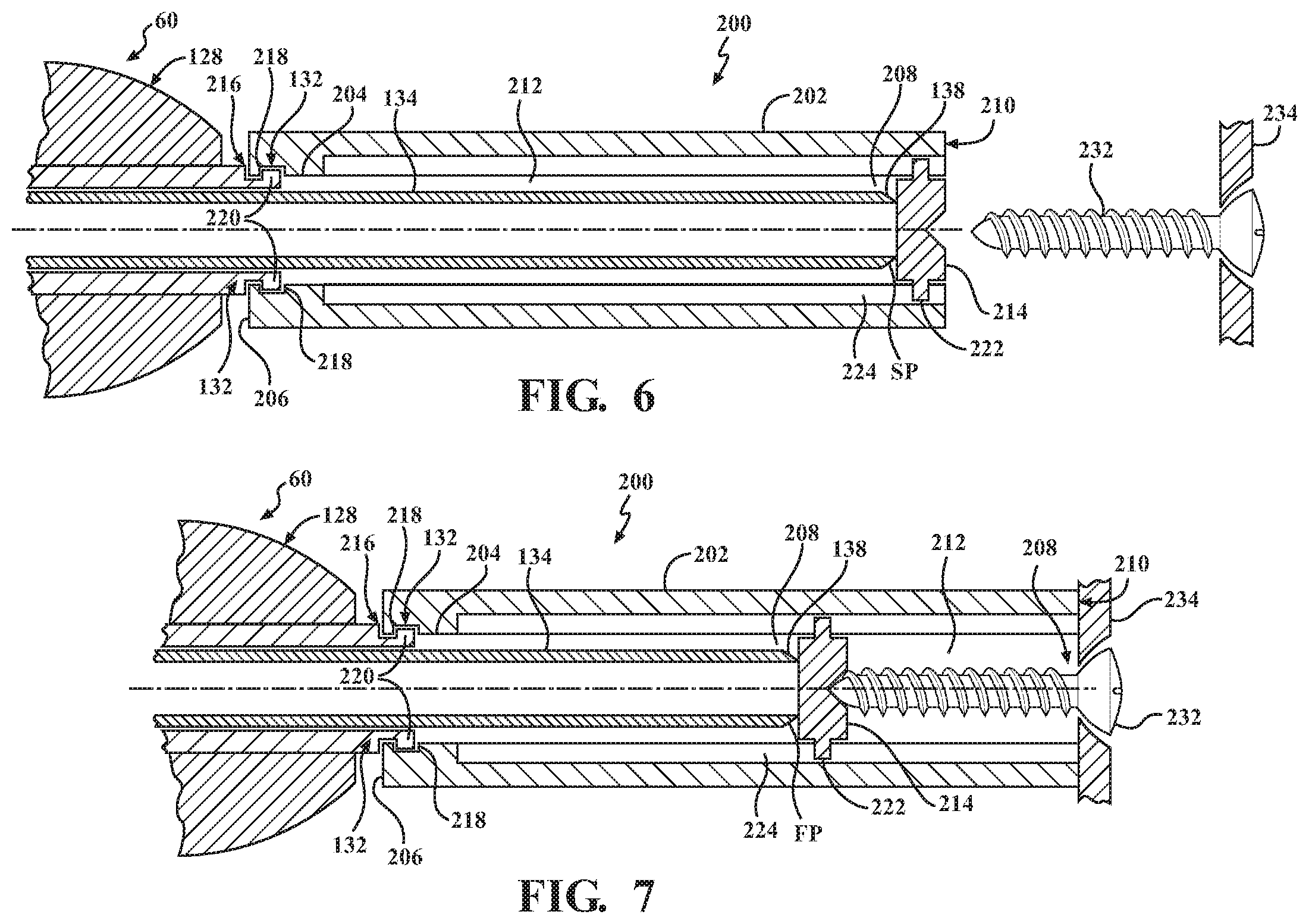 Patent US12426897 Figure 6 – Calibration and adjustment determination of a surgical handpiece system
