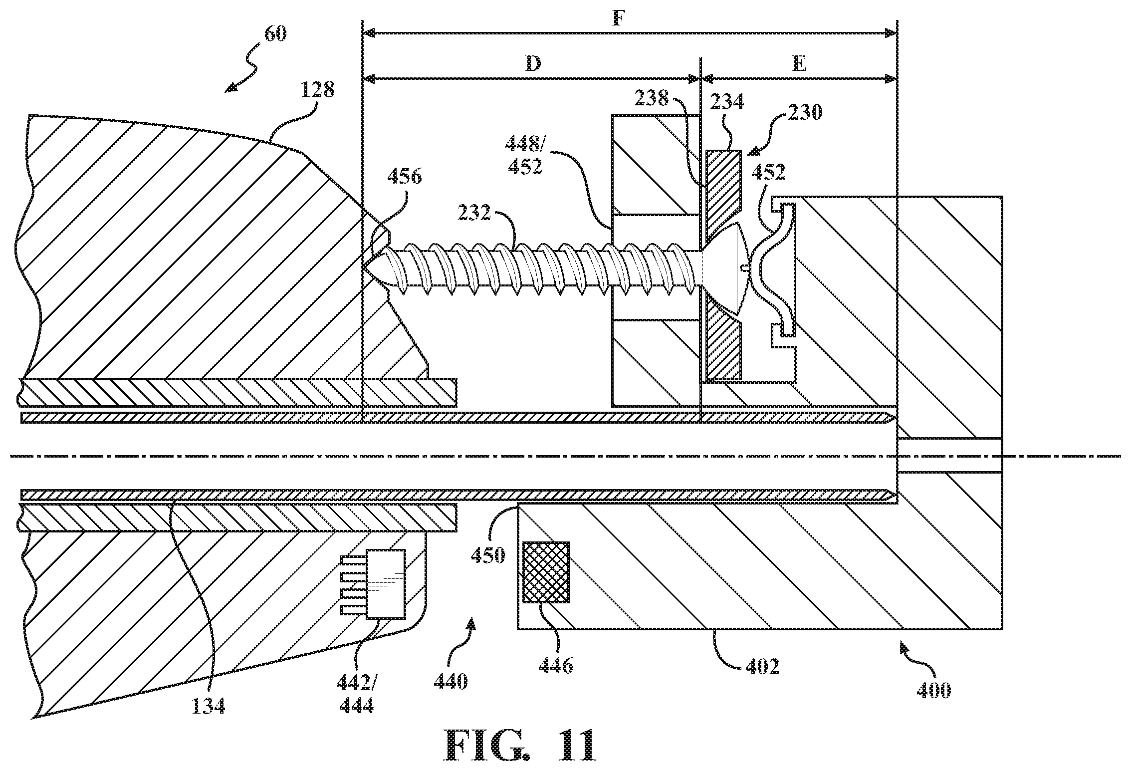 Patent US12426897 Figure 9 – Calibration and adjustment determination of a surgical handpiece system