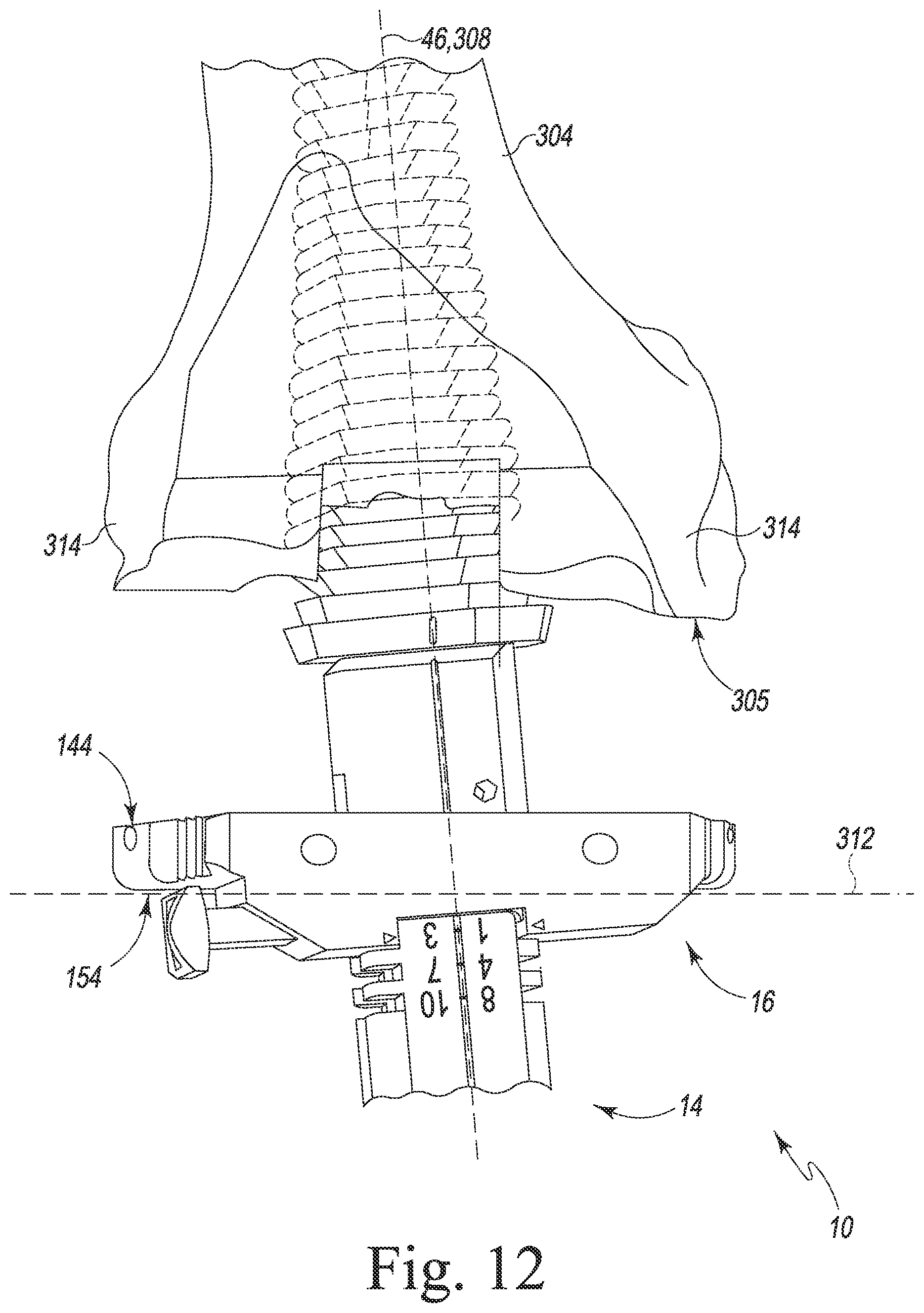 Patent US12426899 Figure 11 – Femoral surgical instrument and method of assembling same