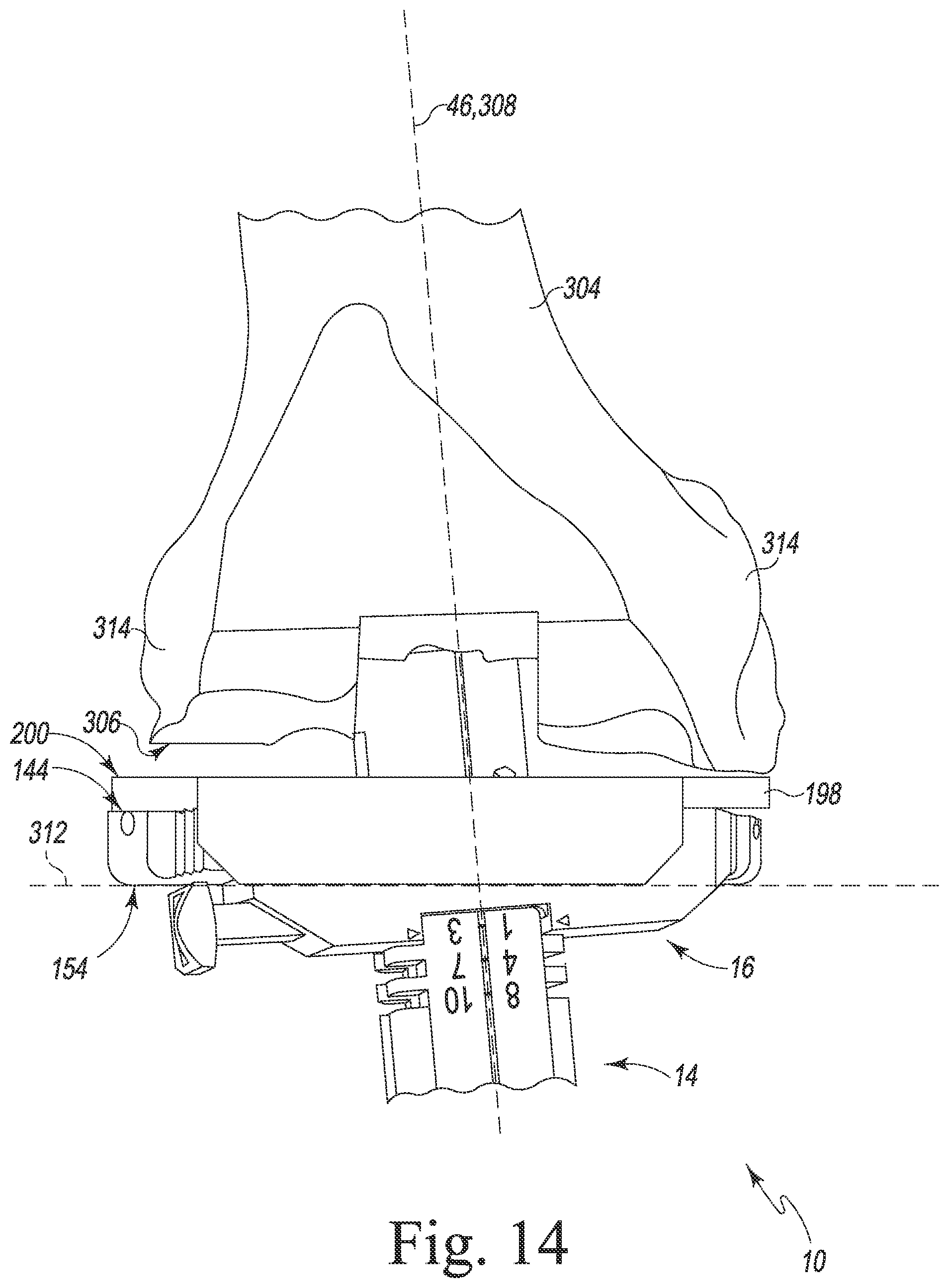 Patent US12426899 Figure 13 – Femoral surgical instrument and method of assembling same