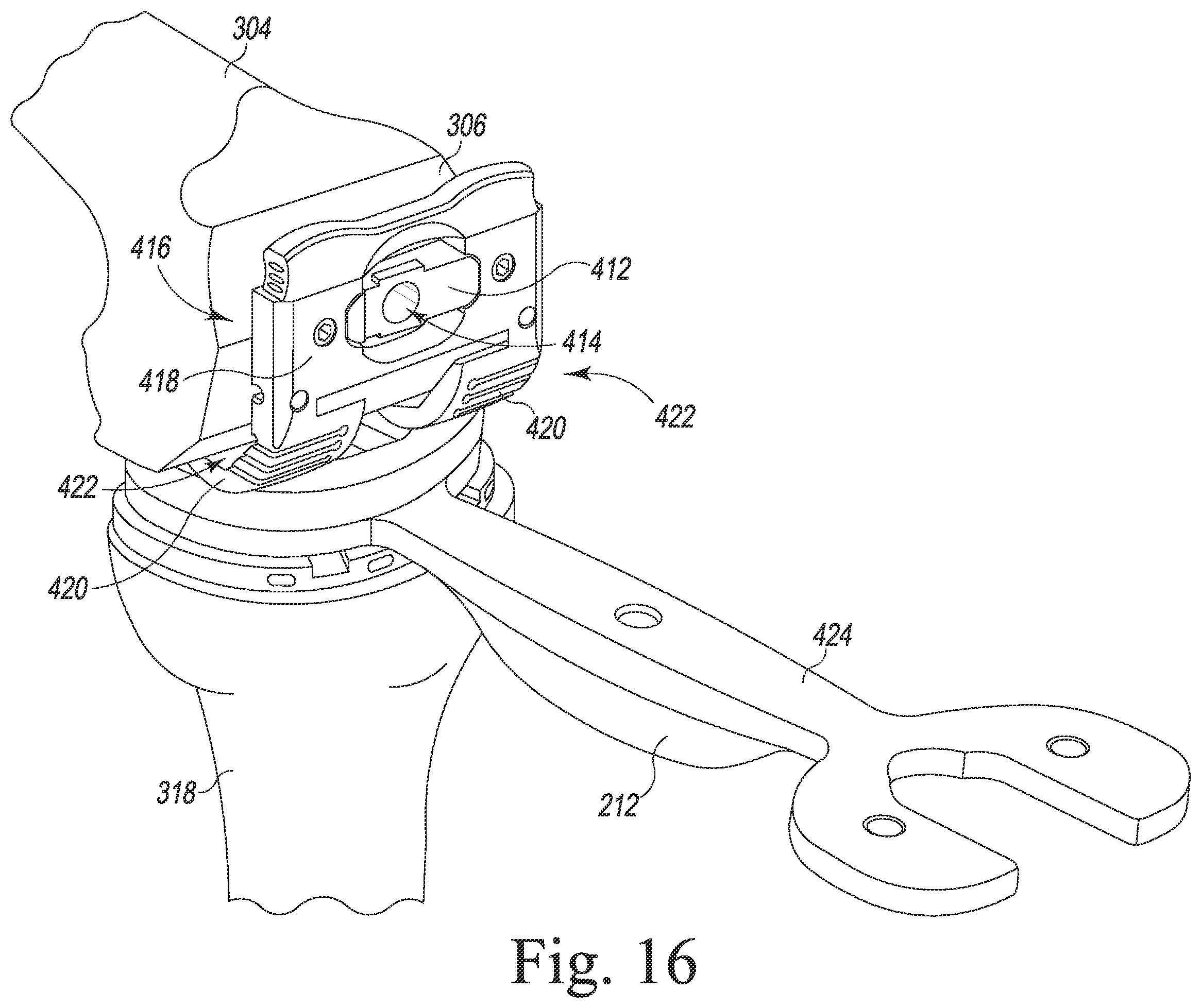 Patent US12426899 Figure 15 – Femoral surgical instrument and method of assembling same