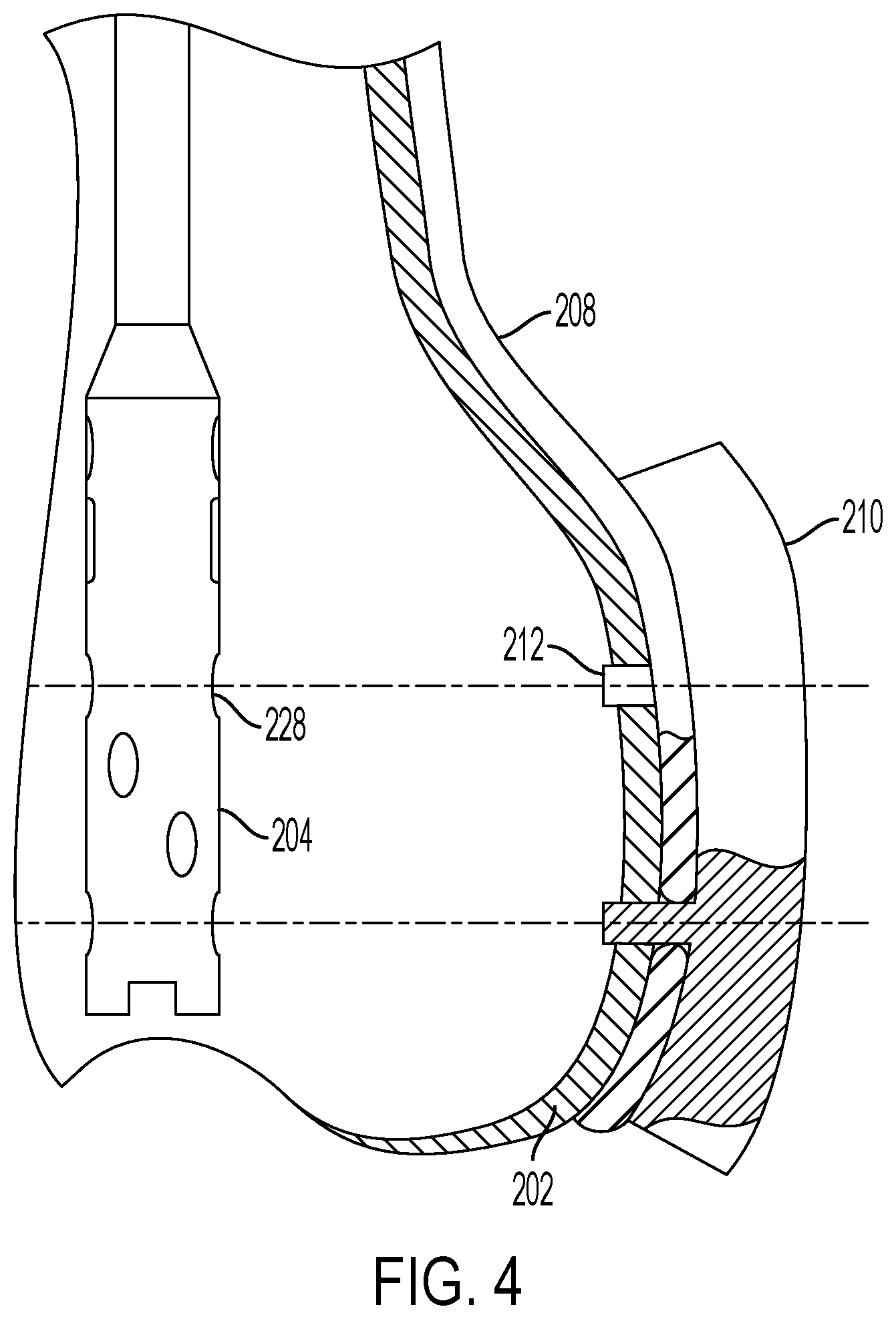 Patent US12426901 Figure 4 – Plate to nail alignment pin/k-wire