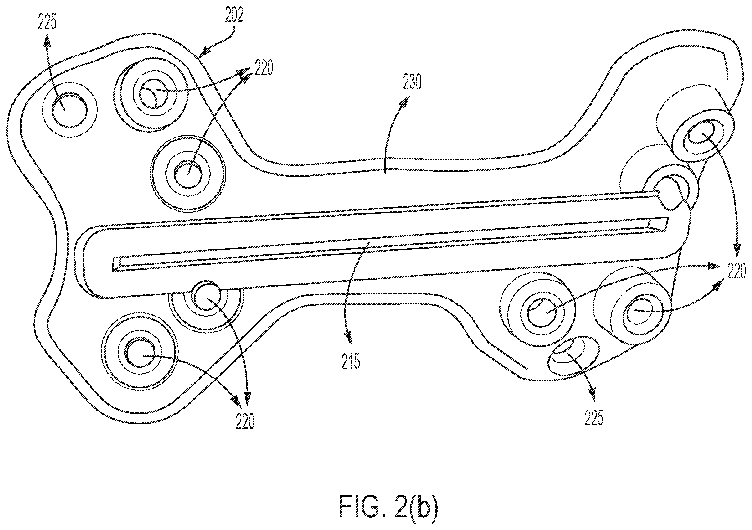 Patent US12426902 Figure 3 – Surgical cutting guides designed for anatomical landmarks