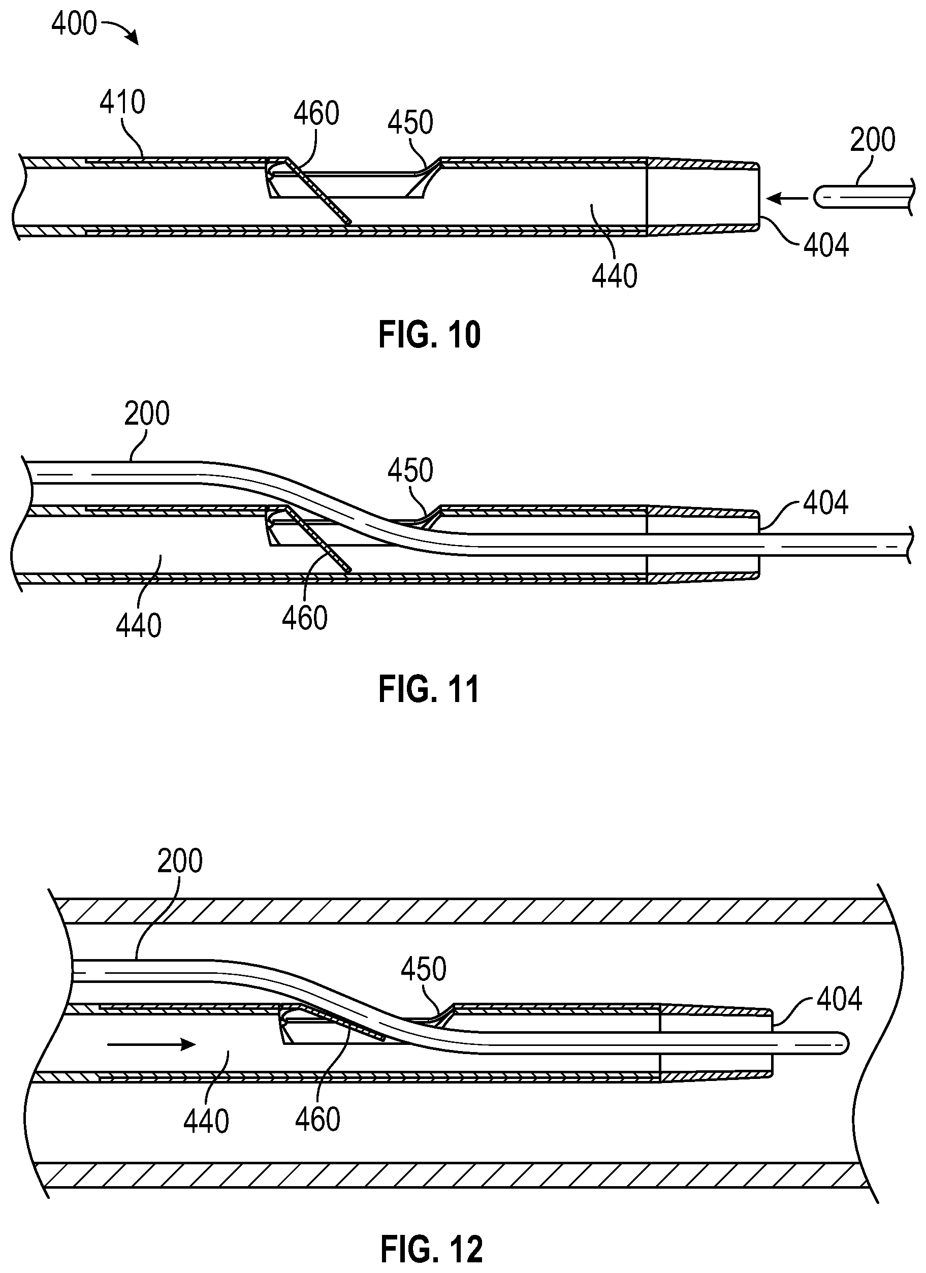Patent US12426903 Figure 5 – Re-entry catheter