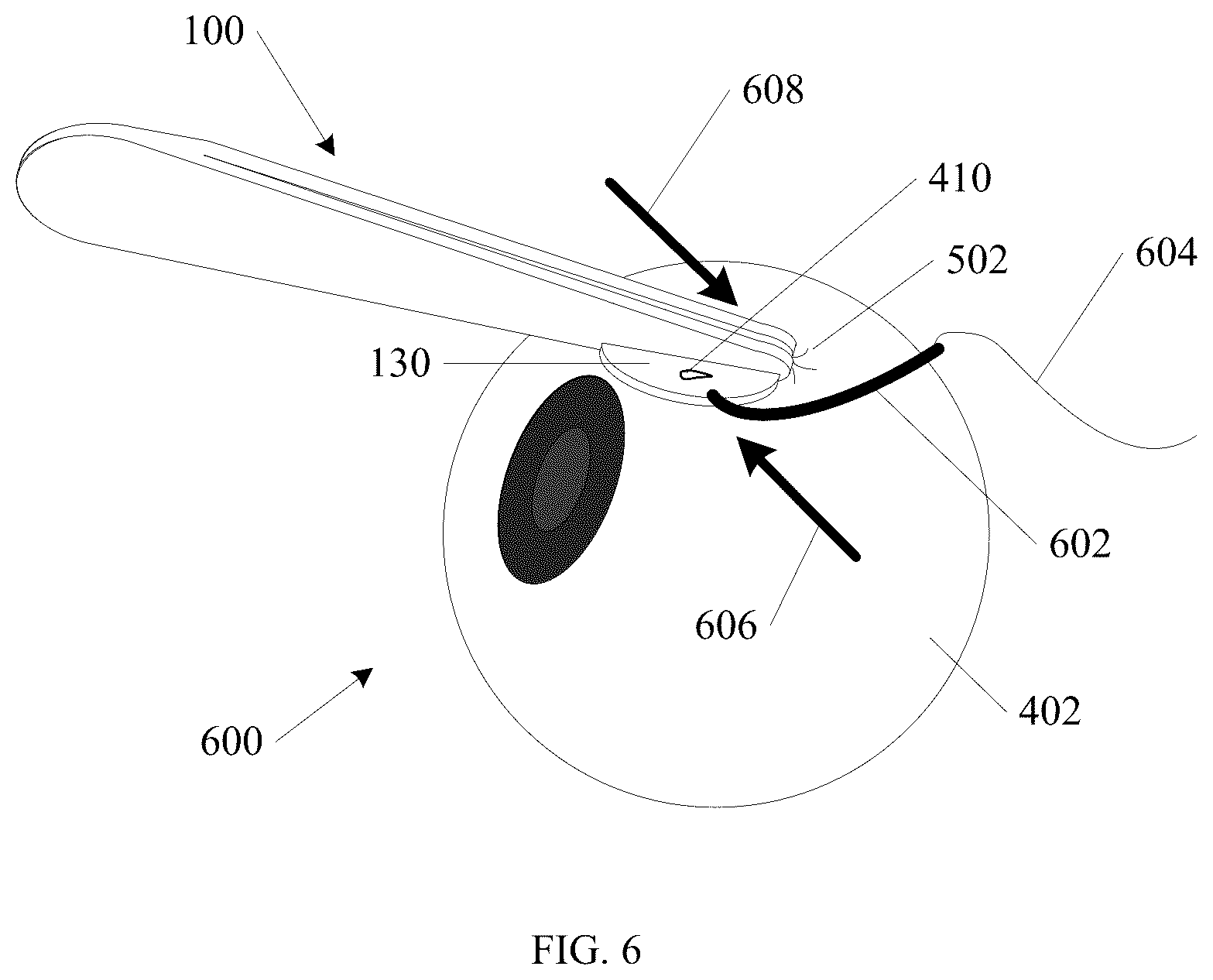 Patent US12426905 Figure 3 – Wound visualization forceps and method