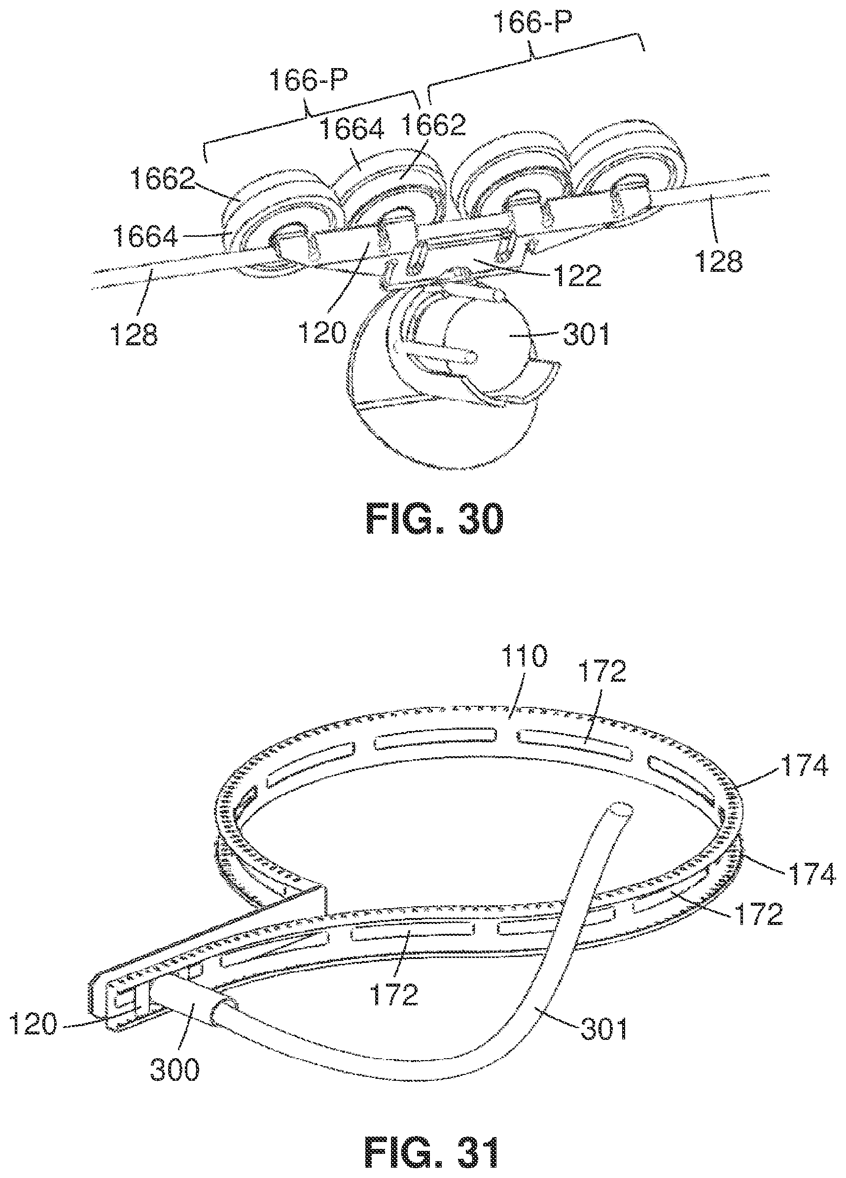 Patent US12426907 Figure 14 – Systems and methods for controllable access of tools to elevated tissues