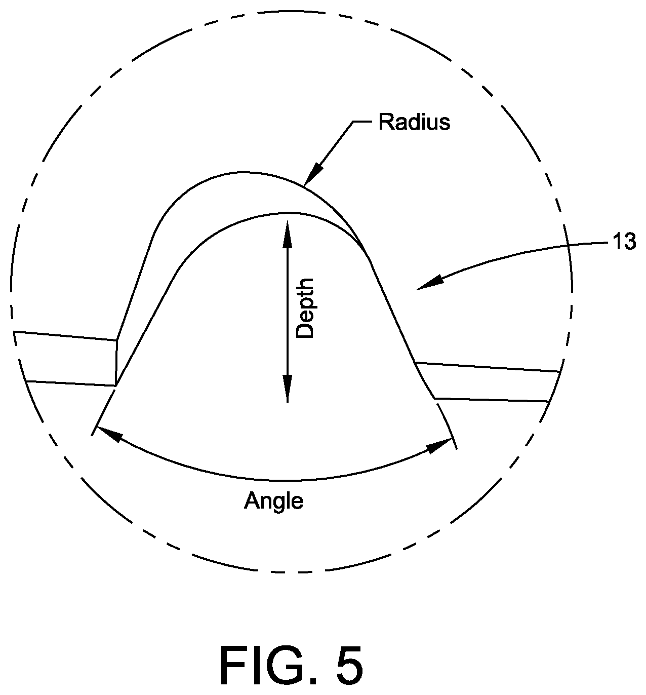 Patent US12426908 Figure 6 – Preferential removal of cartilage